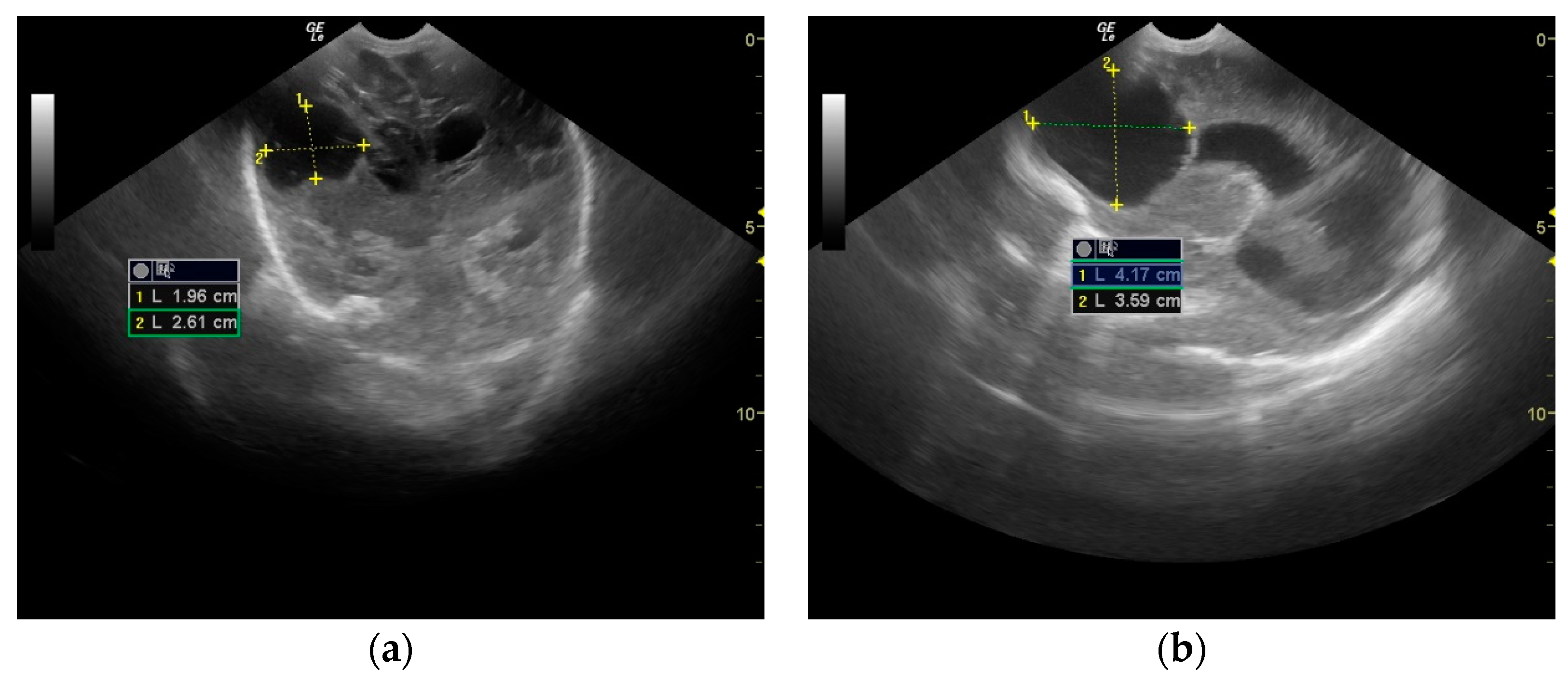 Antibiotics 12 00722 g004