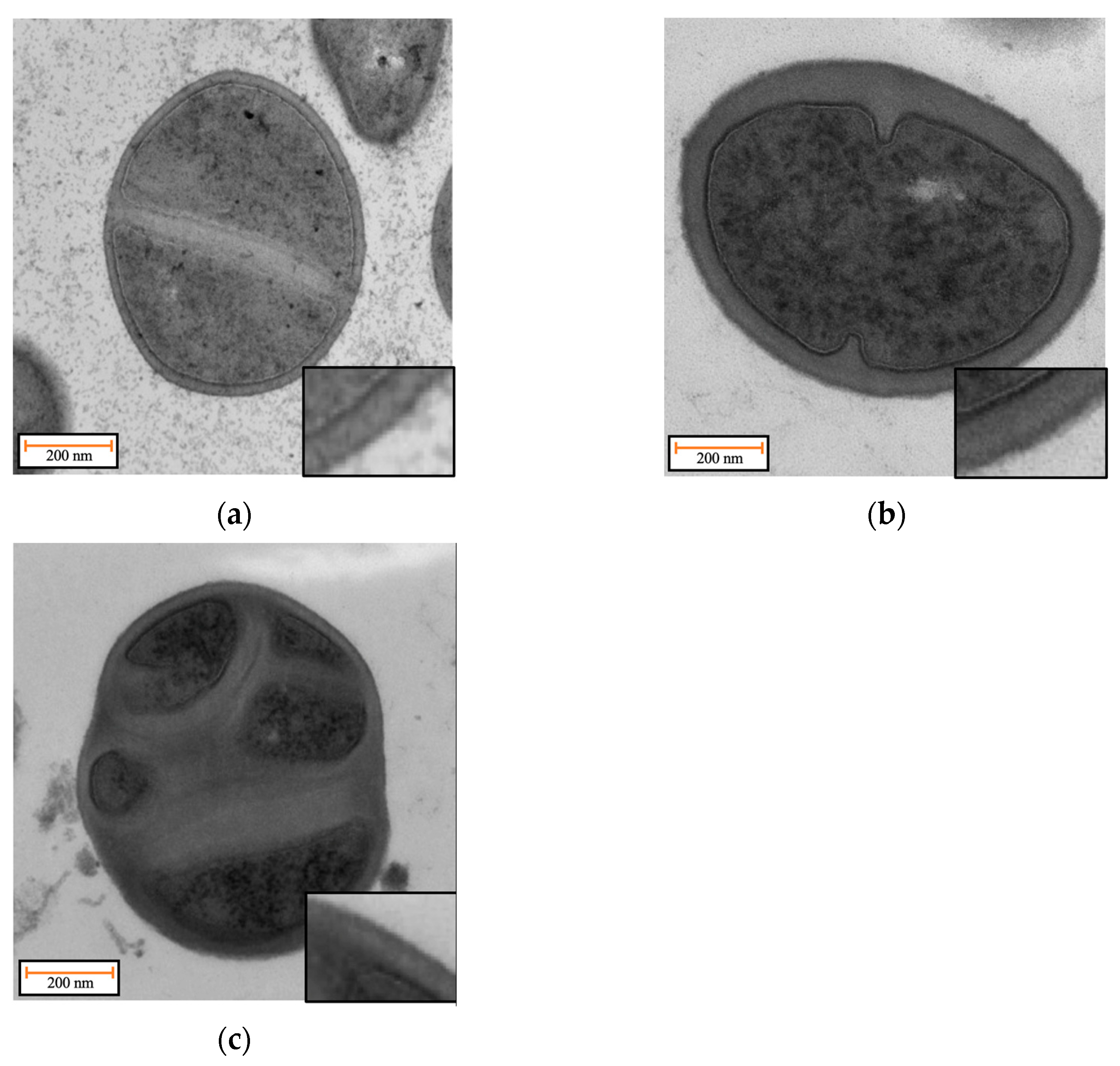 Antibiotics 12 00947 g006