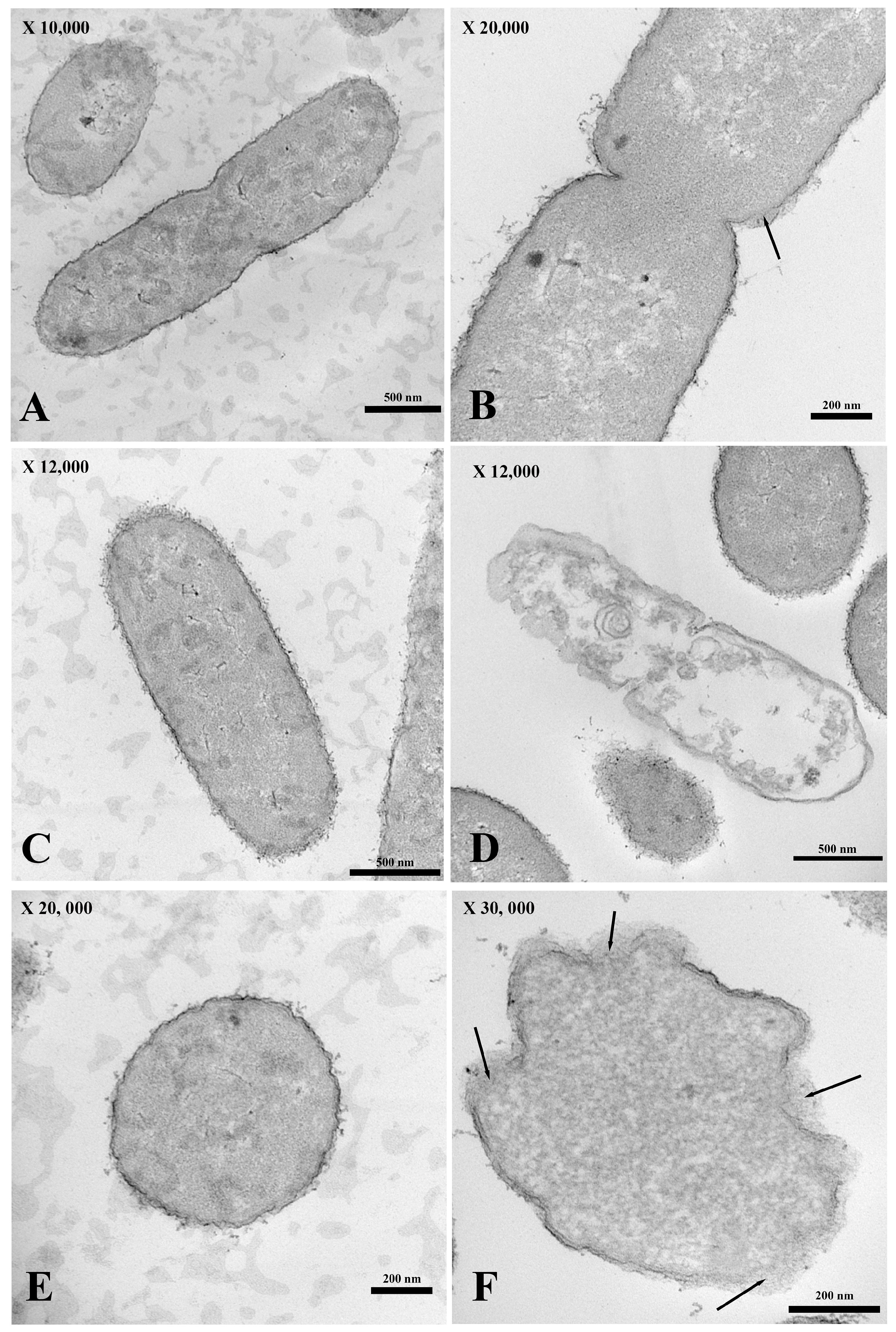 Antibiotics 13 00138 g004