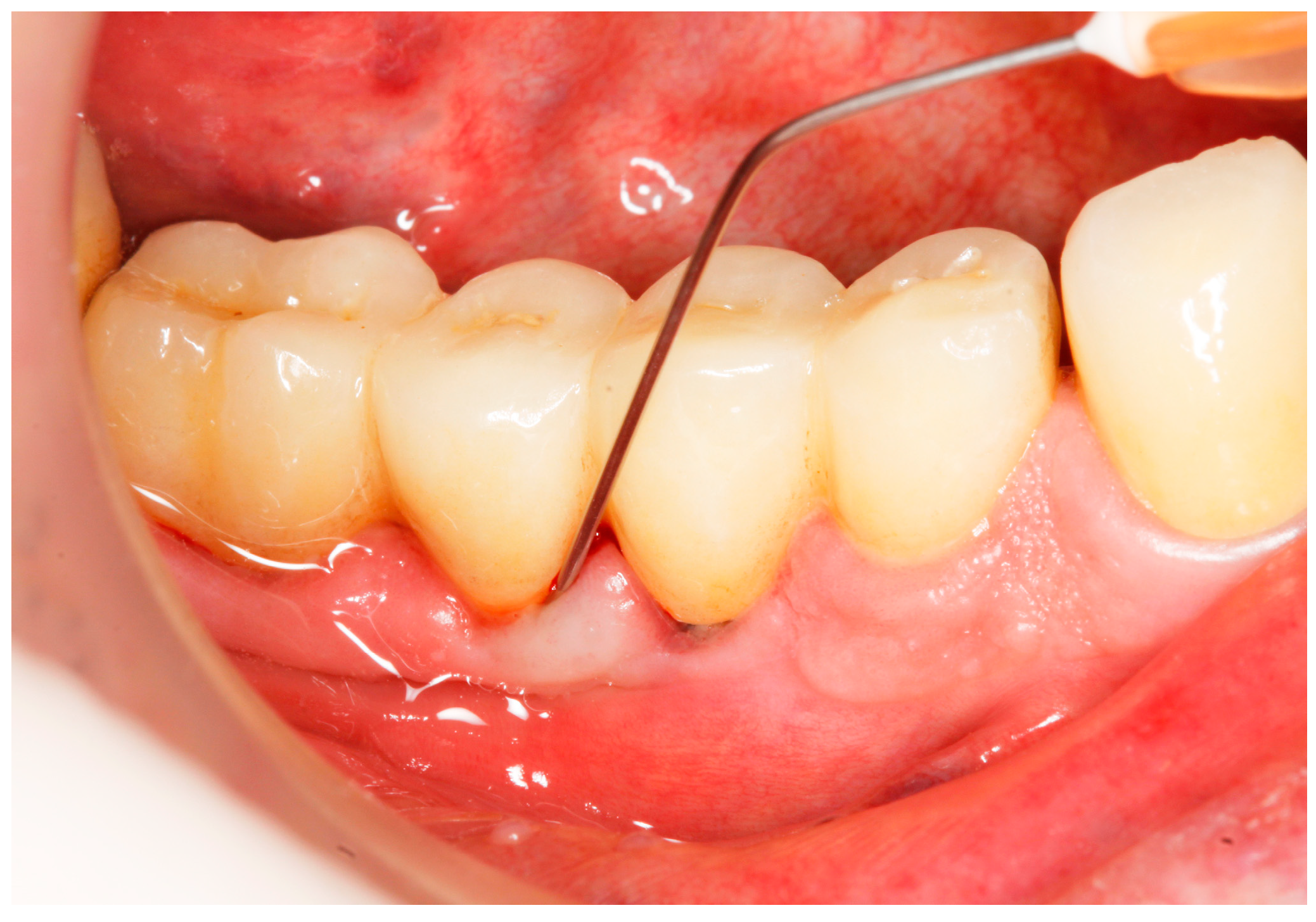 Antibiotics 13 00269 g004 Antibiotics 13 00269 g004