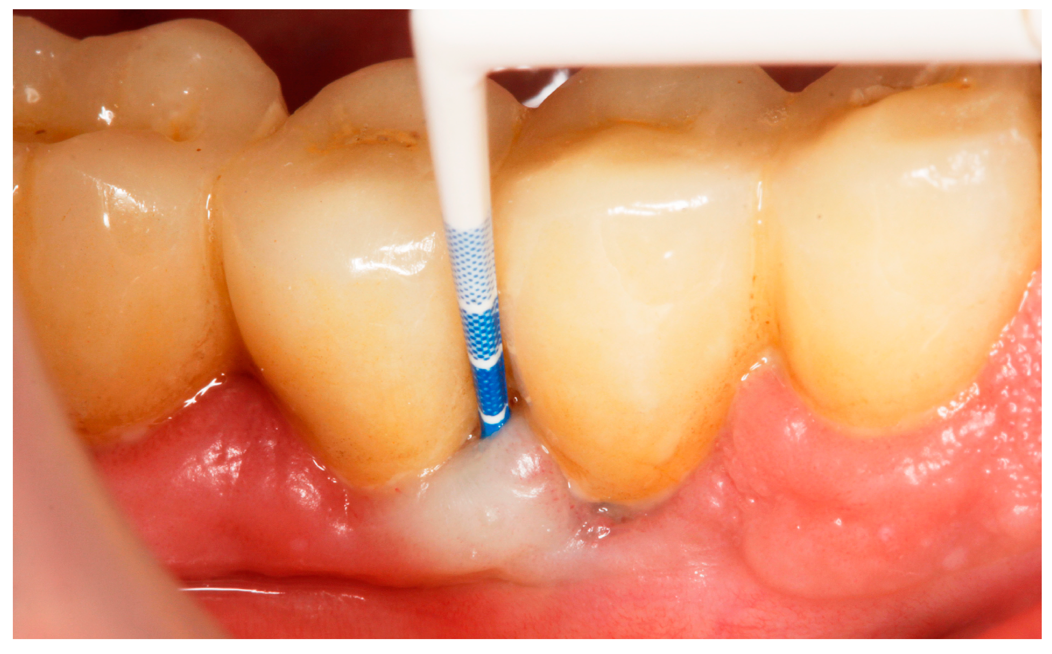 Antibiotics 13 00269 g006 Antibiotics 13 00269 g006