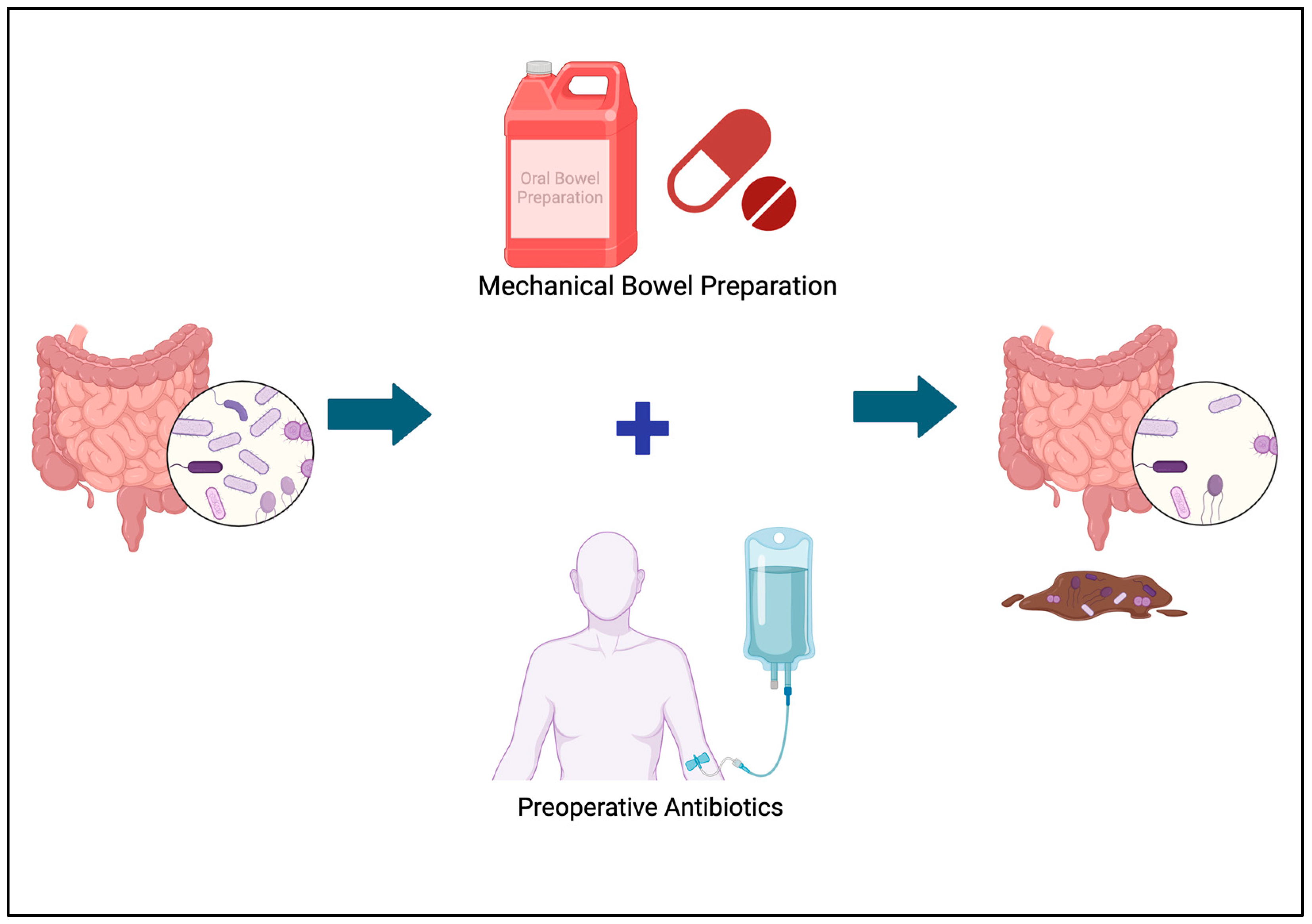 Antibiotics 13 00317 g003