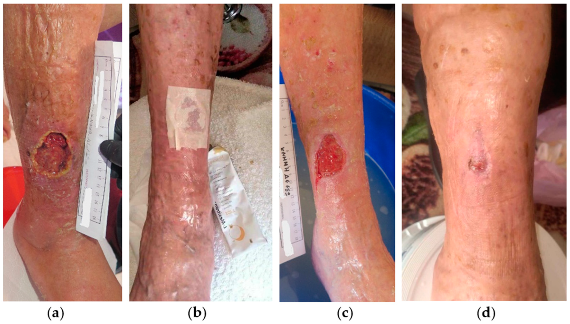 Antibiotics 13 00614 g001