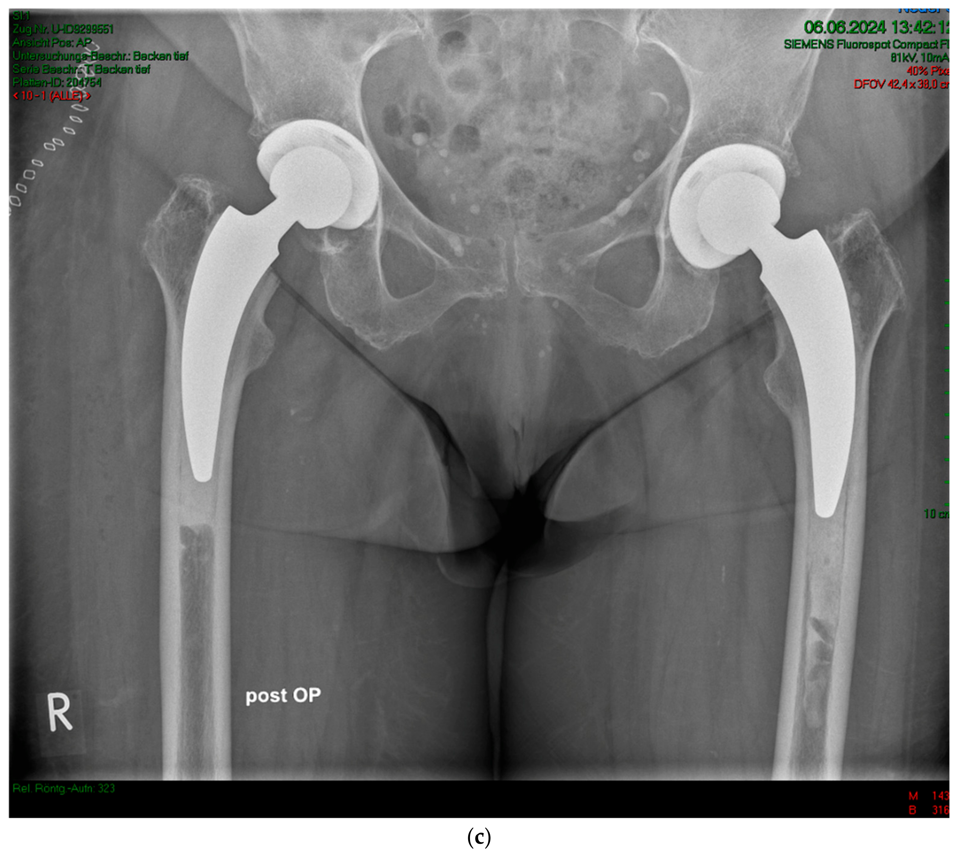 Antibiotics 13 00739 g003b
