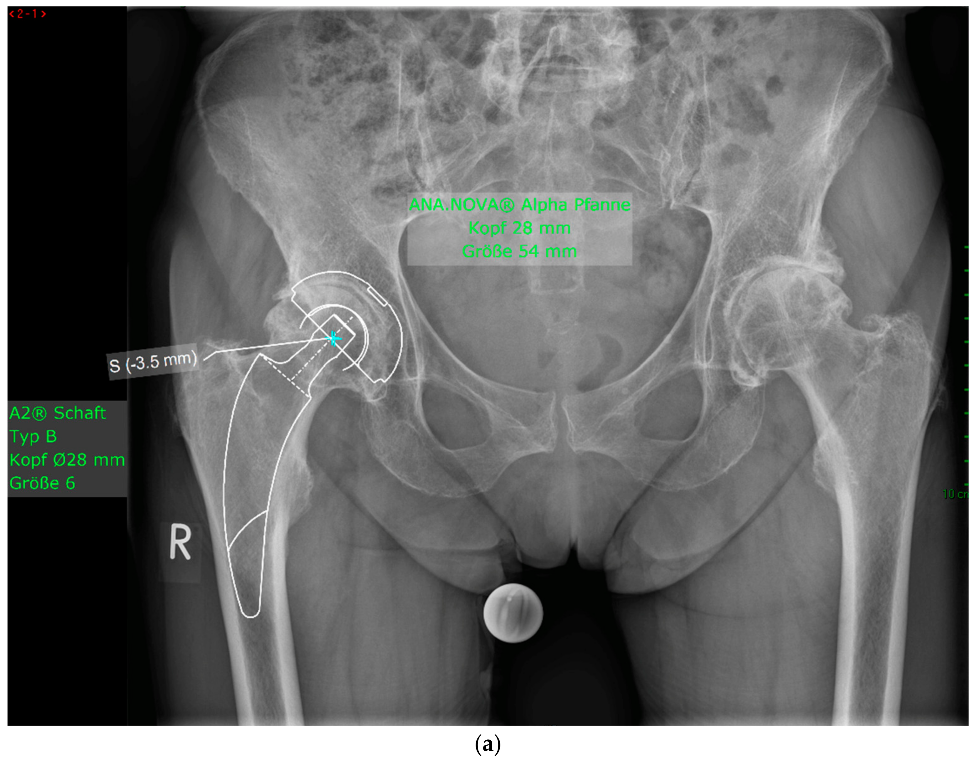Antibiotics 13 00739 g004a