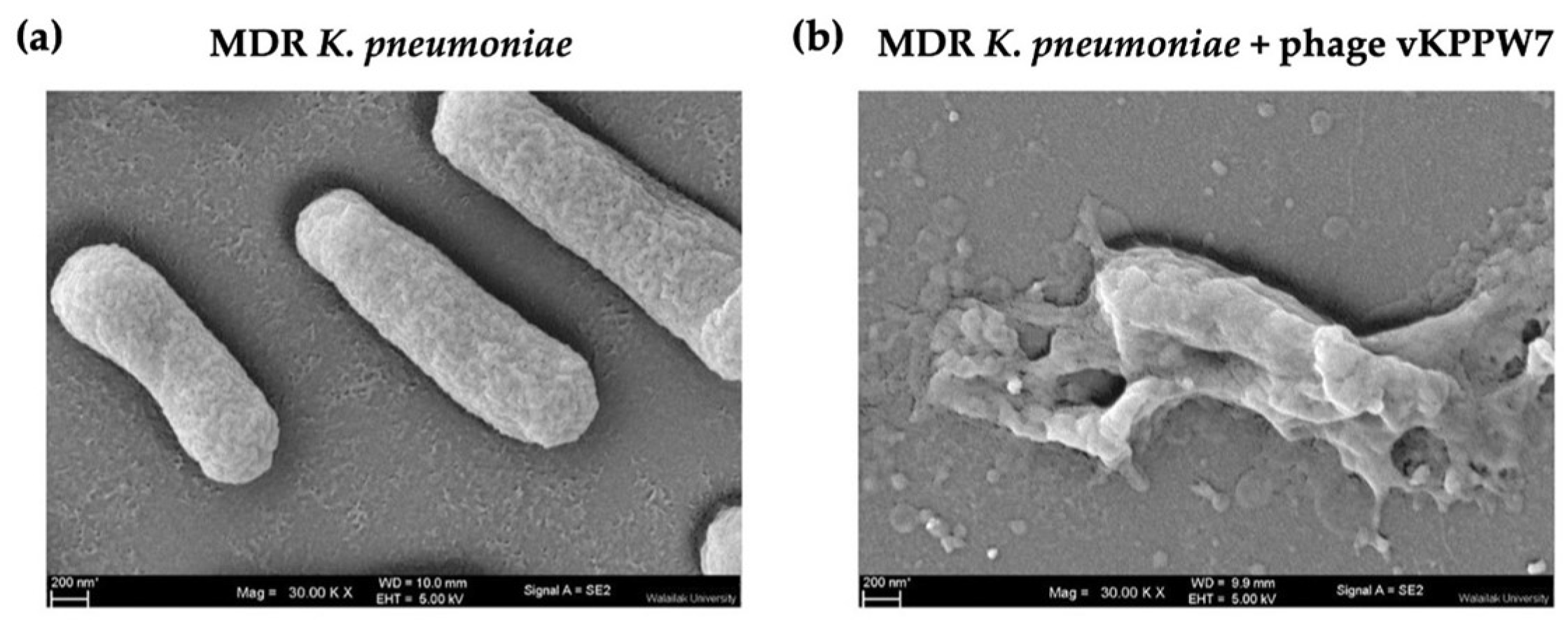 Antibiotics 14 00157 g003 Antibiotics 14 00157 g003