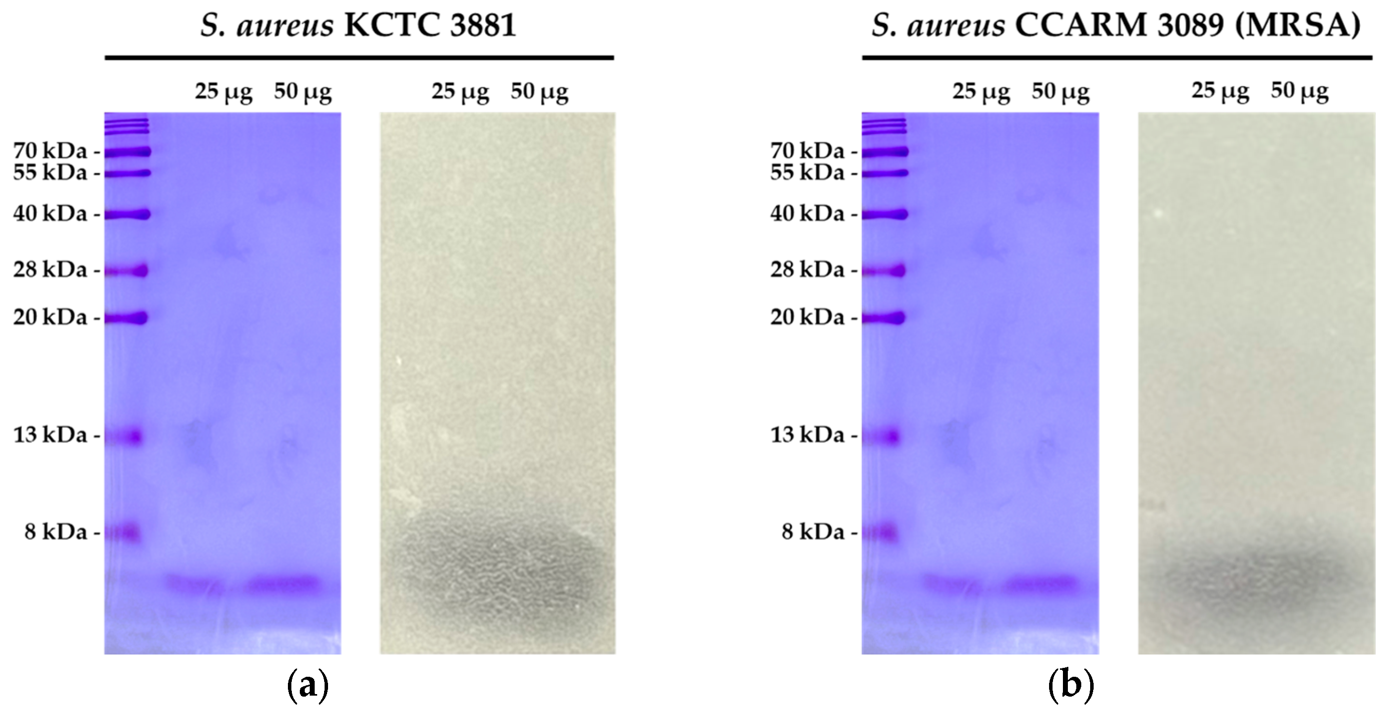 Antibiotics 14 00389 g004