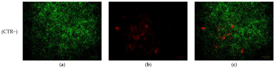 Antibiotics 15 00711 g012a Antibiotics 15 00711 g012a