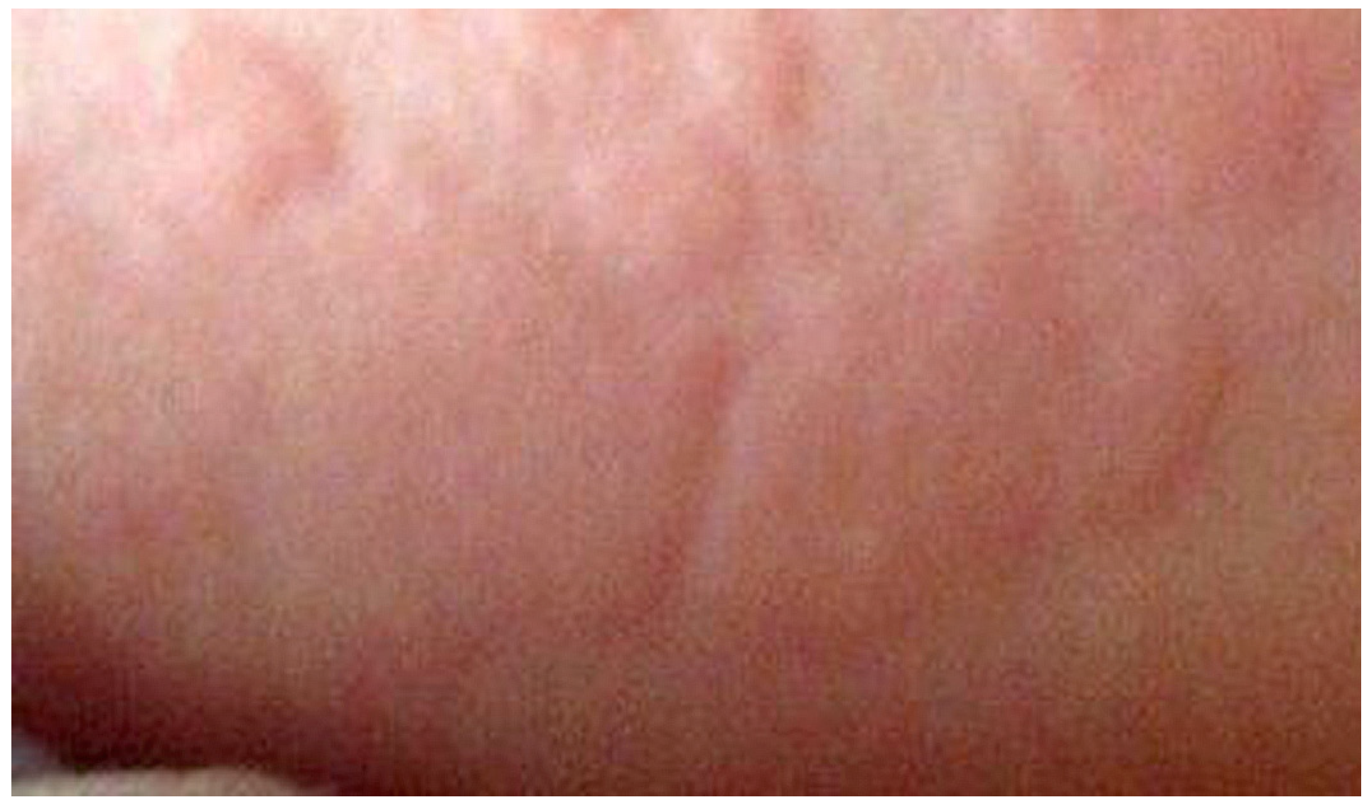 Antibodies 03 00056 g002