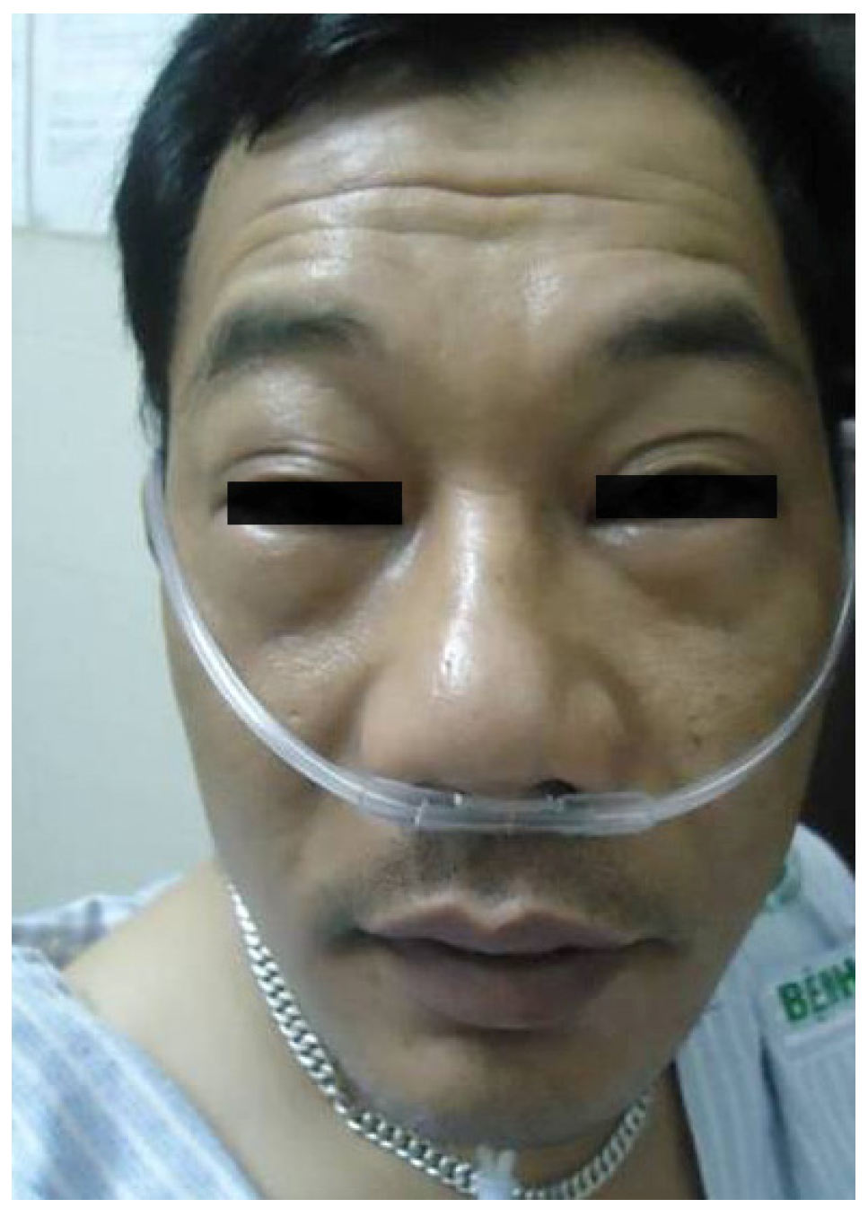 Antibodies 03 00056 g003