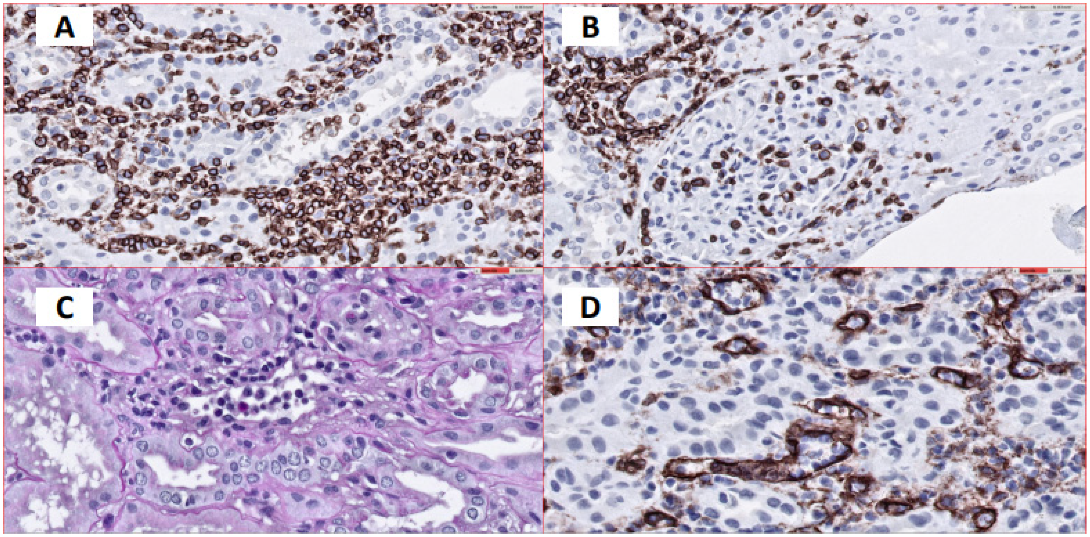 Antibodies 10 00028 g004