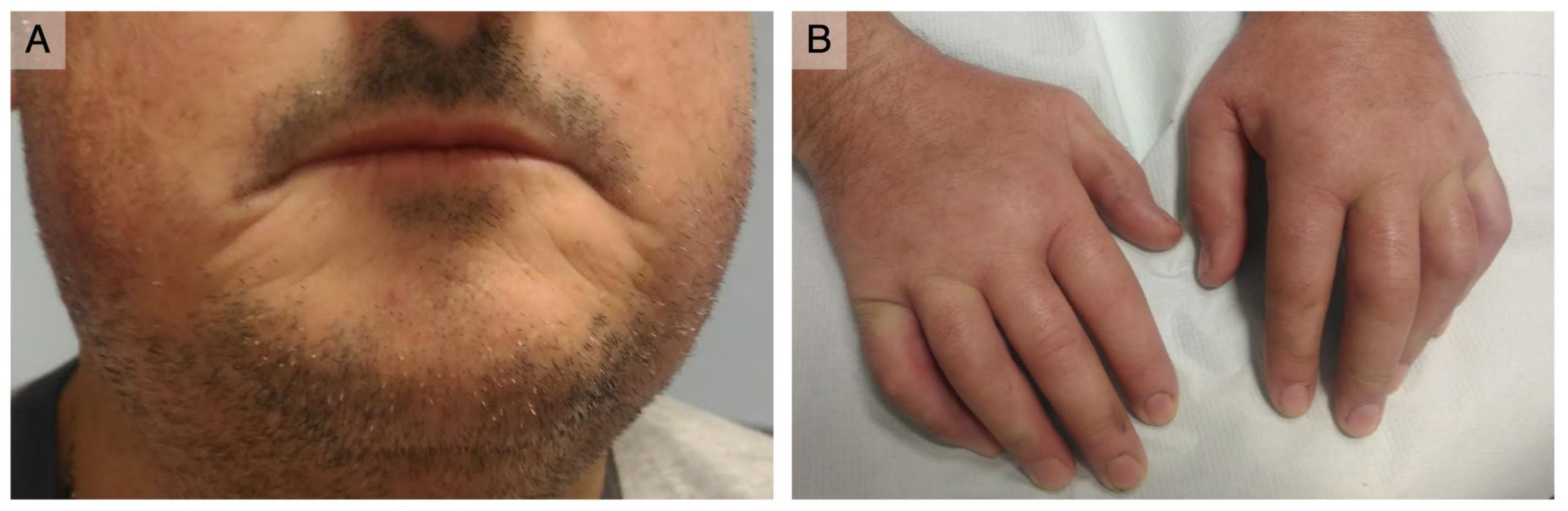 Antibodies 12 00013 g001