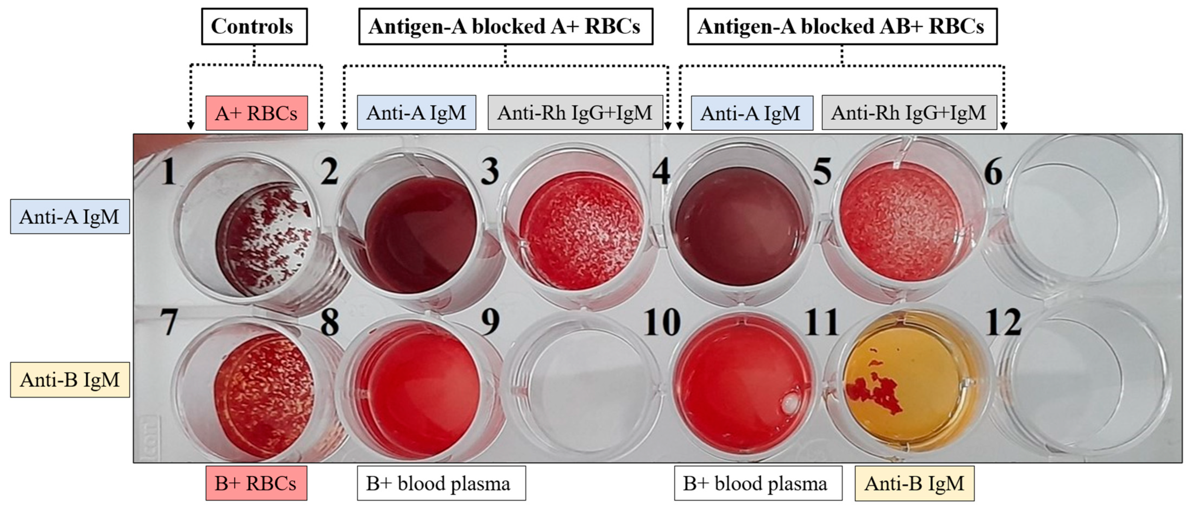 Antibodies 13 00064 g008 Antibodies 13 00064 g008