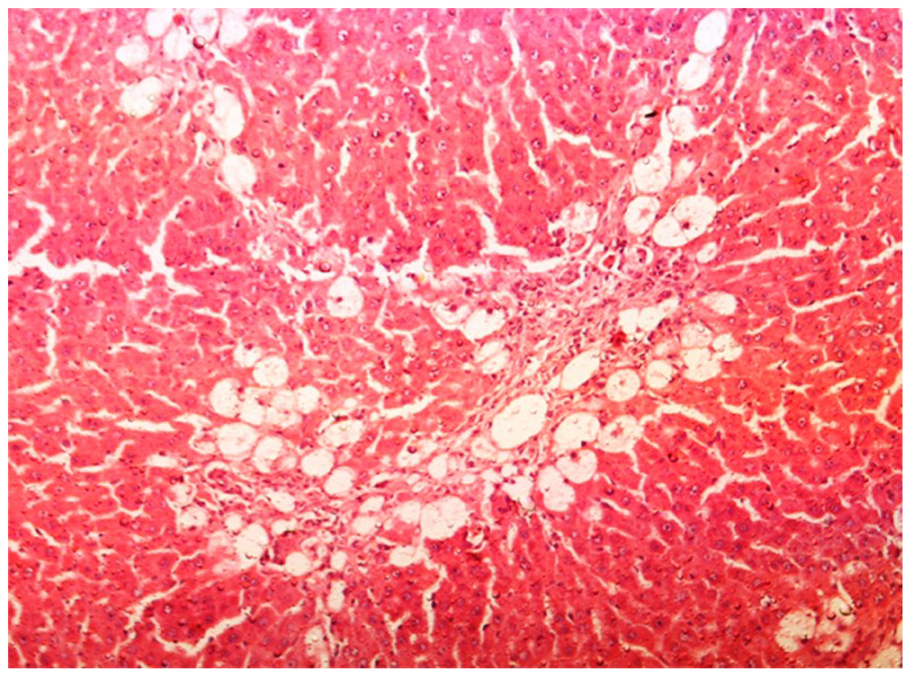 Antioxidants 03 00798 g003 1024