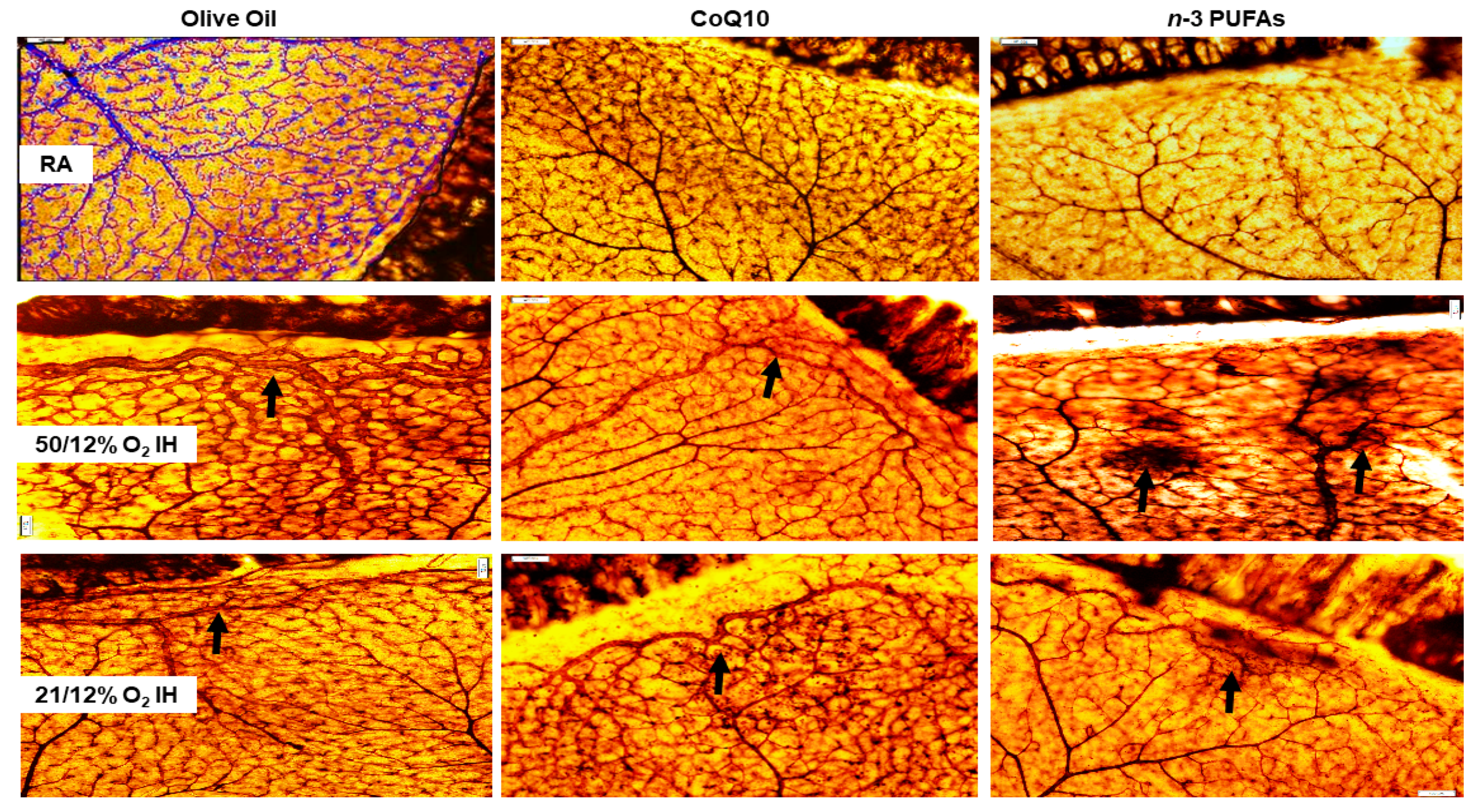 Antioxidants 07 00160 g004