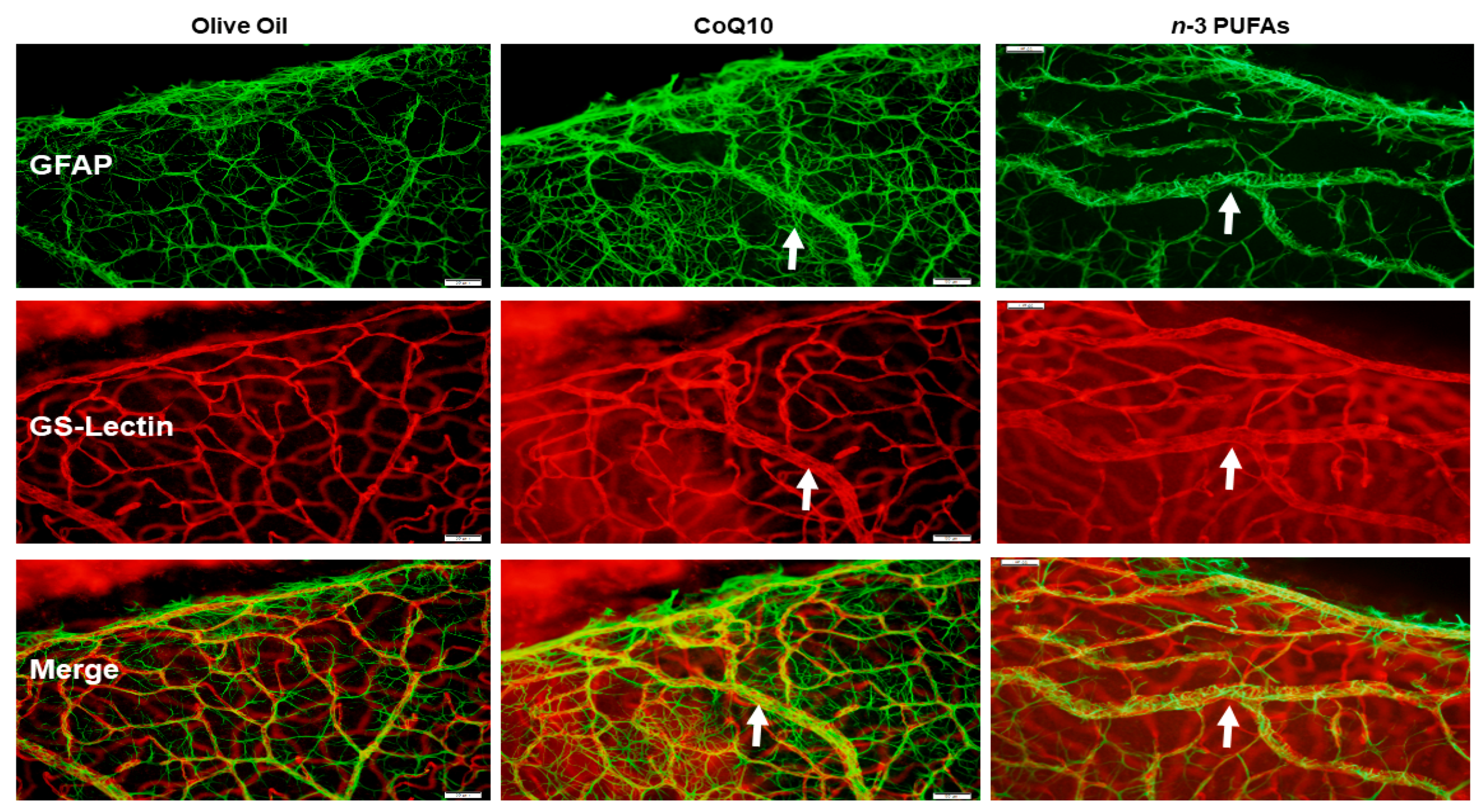 Antioxidants 07 00160 g005