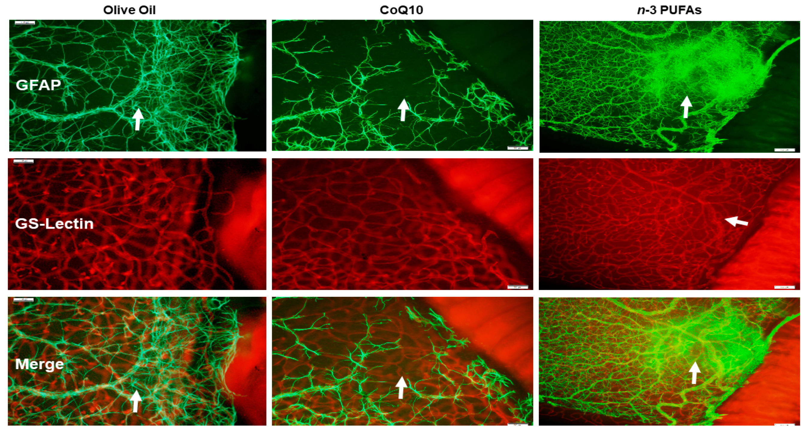 Antioxidants 07 00160 g006