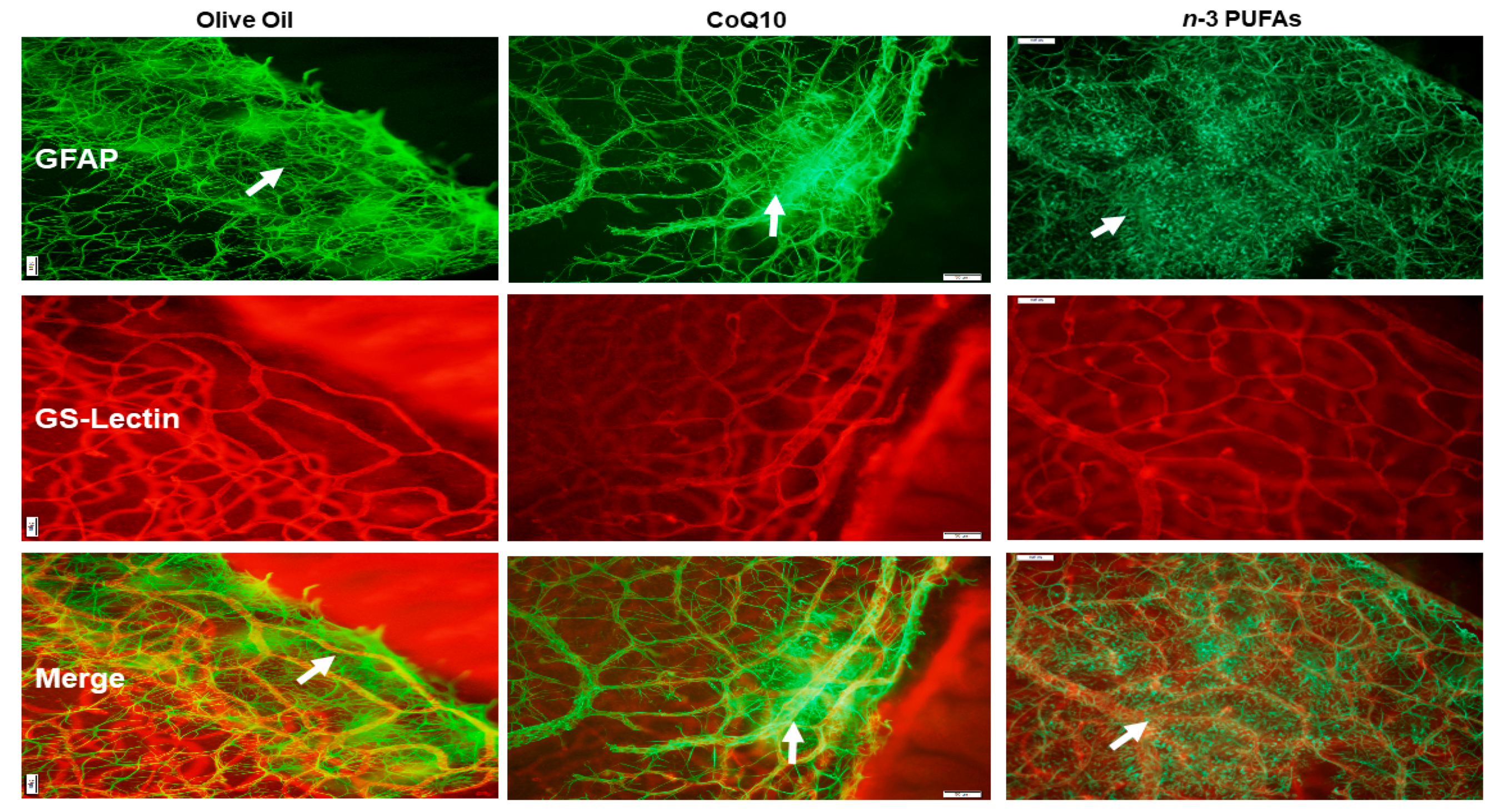 Antioxidants 07 00160 g007