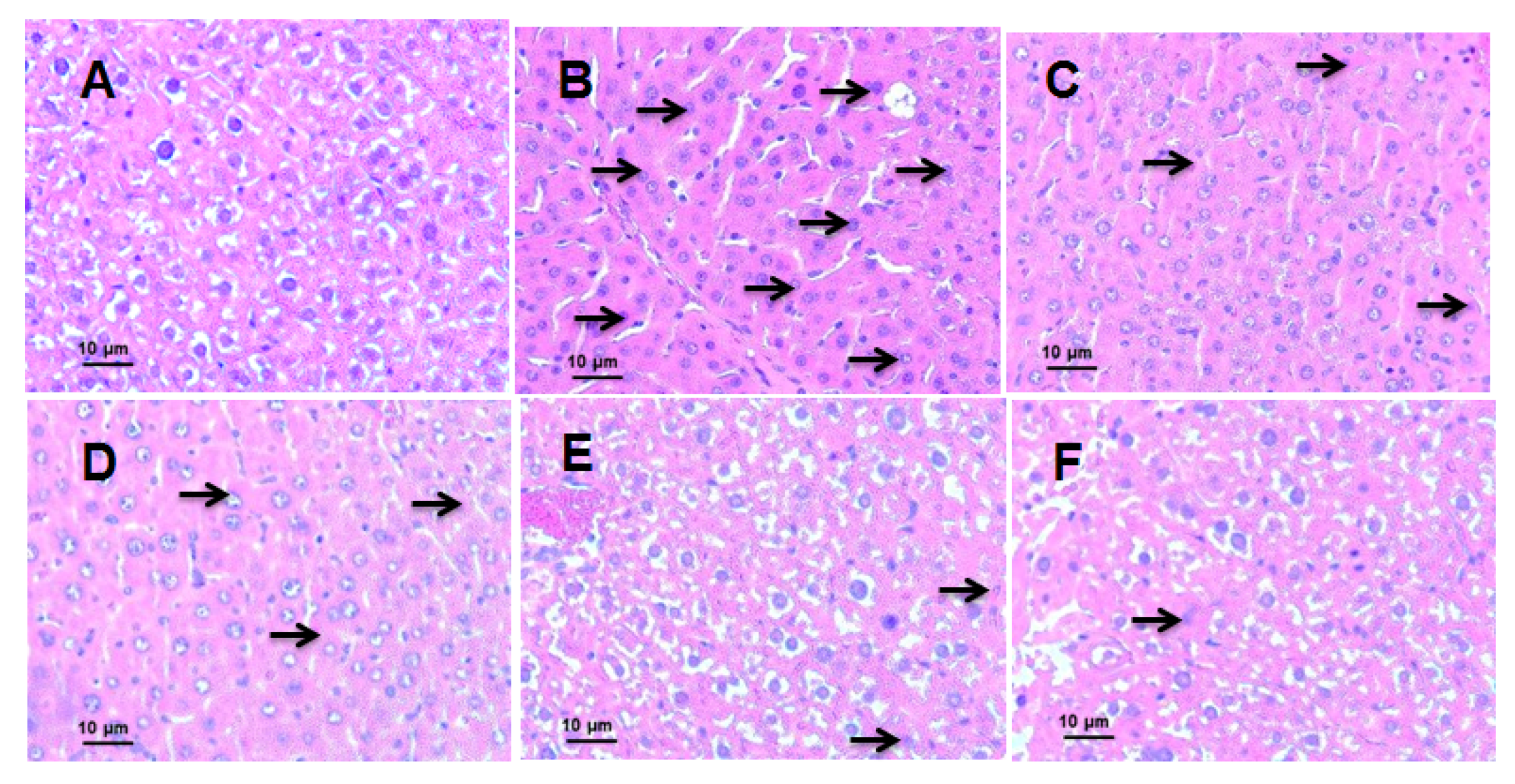 Antioxidants 08 00446 g004a Antioxidants 08 00446 g004a