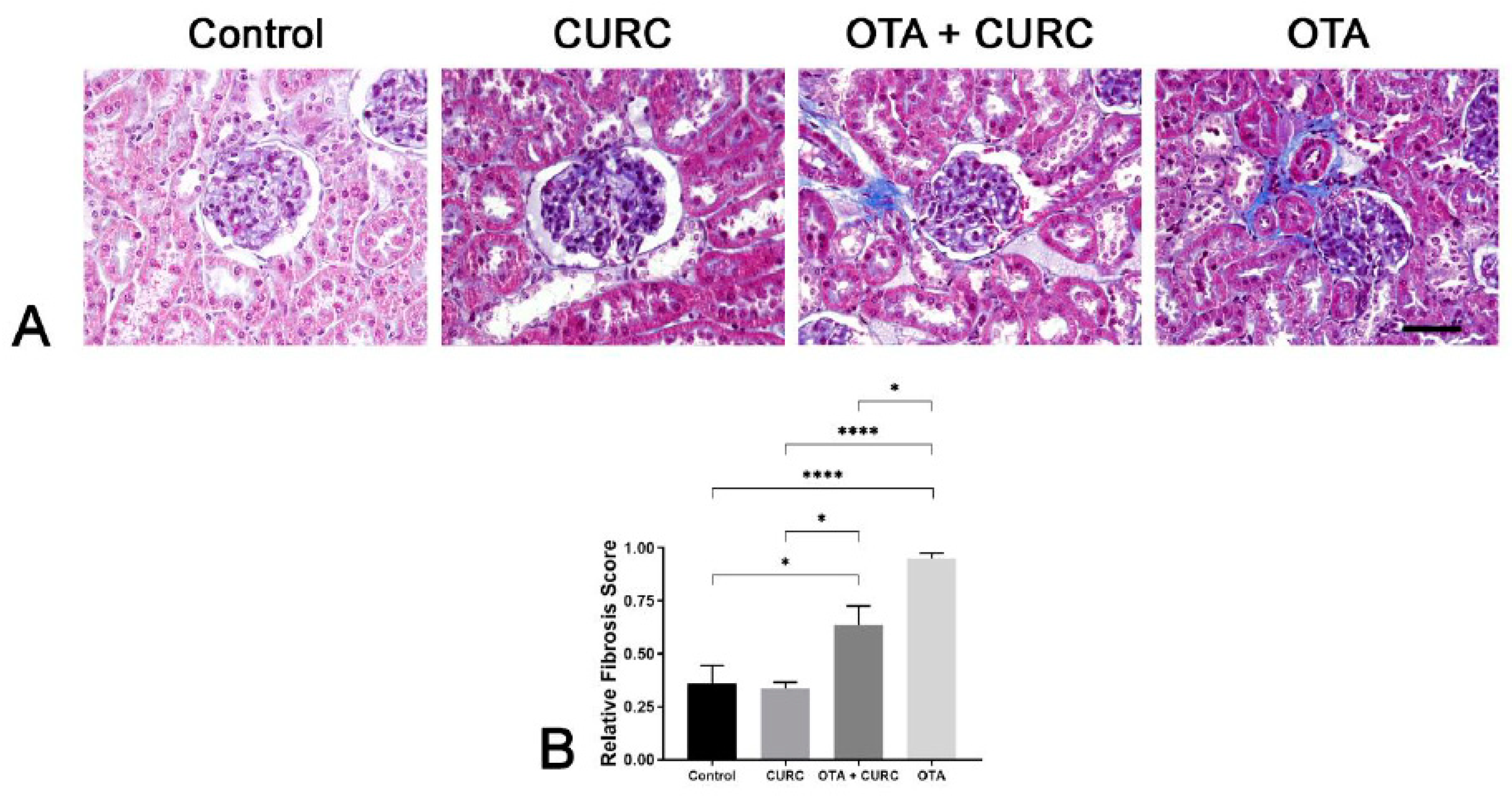 Antioxidants 09 00332 g005