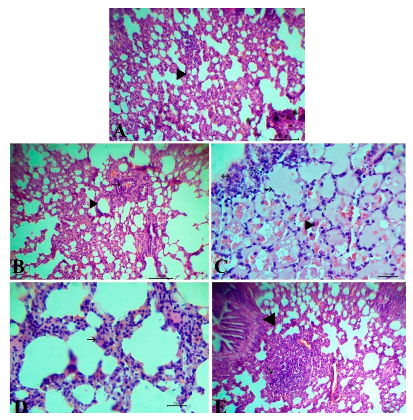 Antioxidants 09 00396 g005