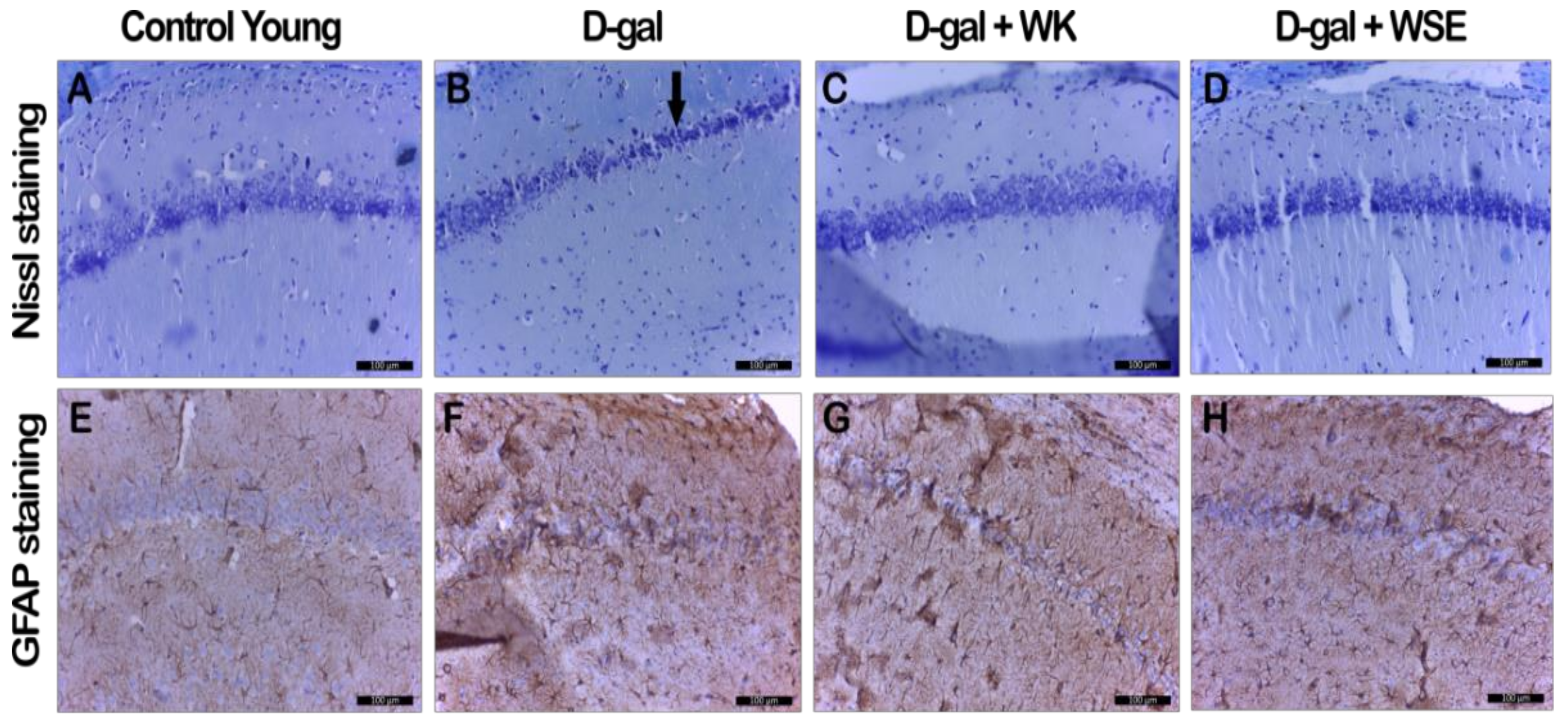 Antioxidants 09 00424 g009