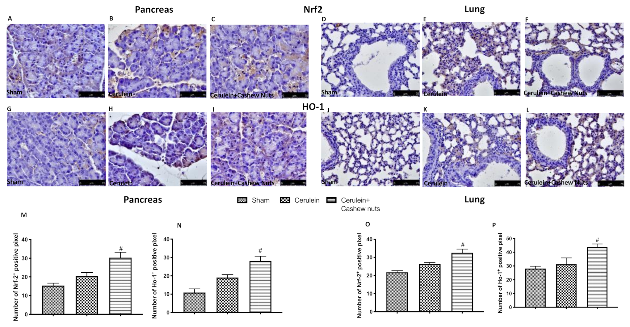 Antioxidants 09 00992 g005