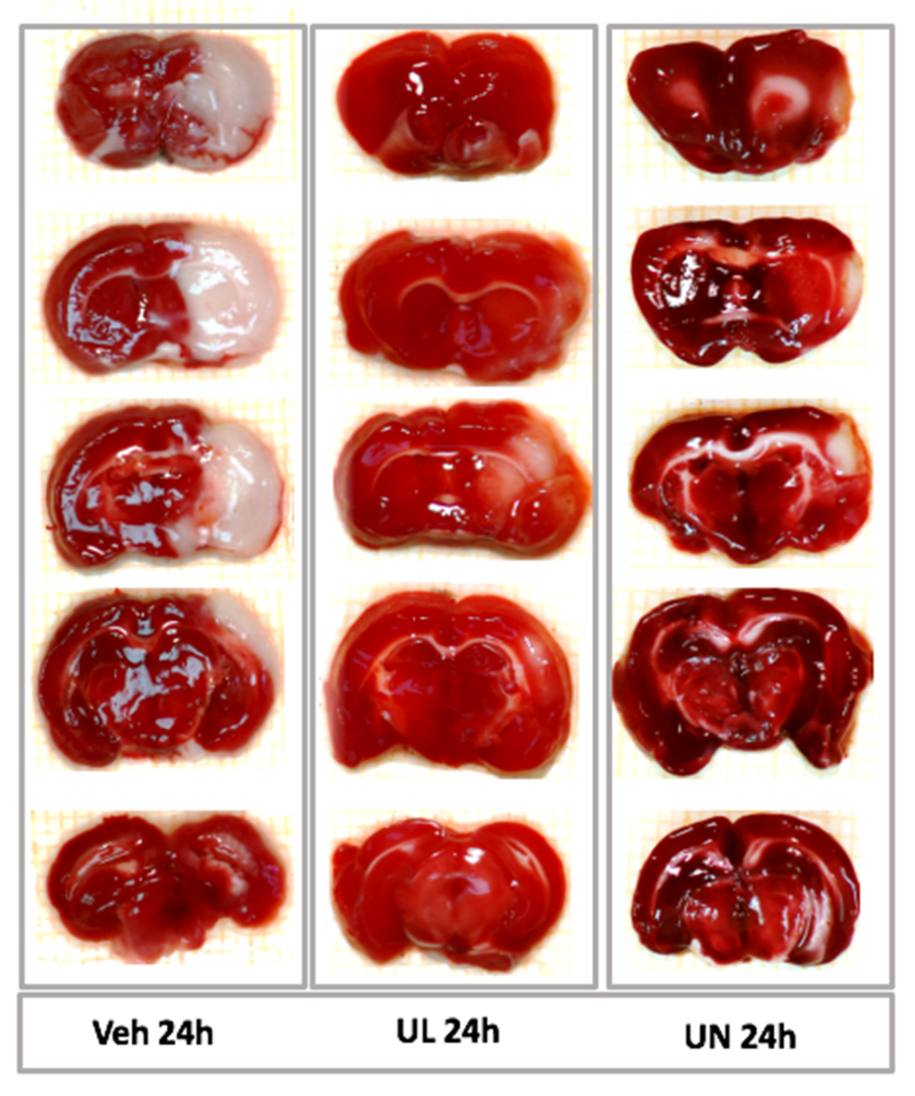 Antioxidants 09 01240 g009