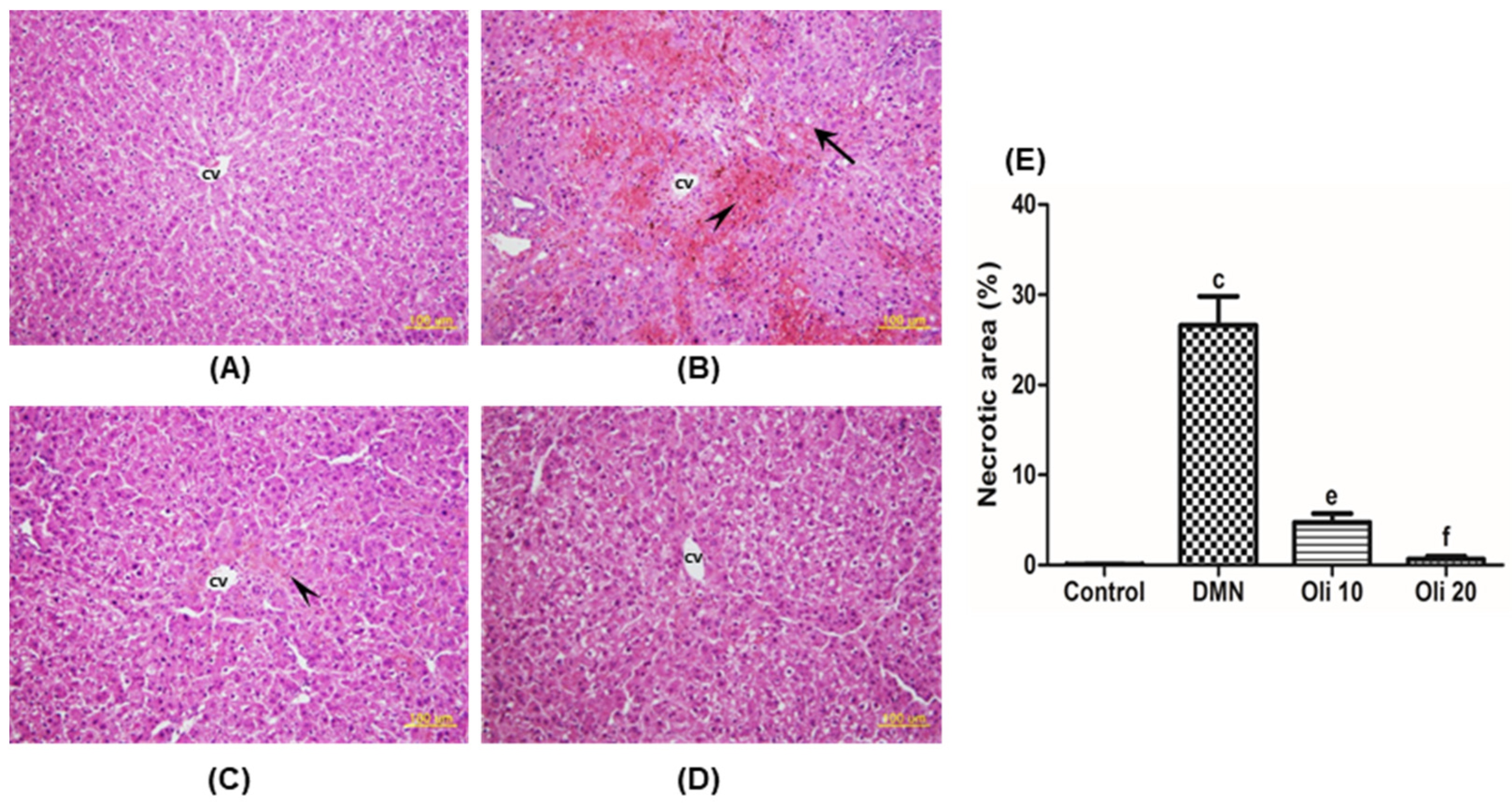 Antioxidants 10 00366 g003