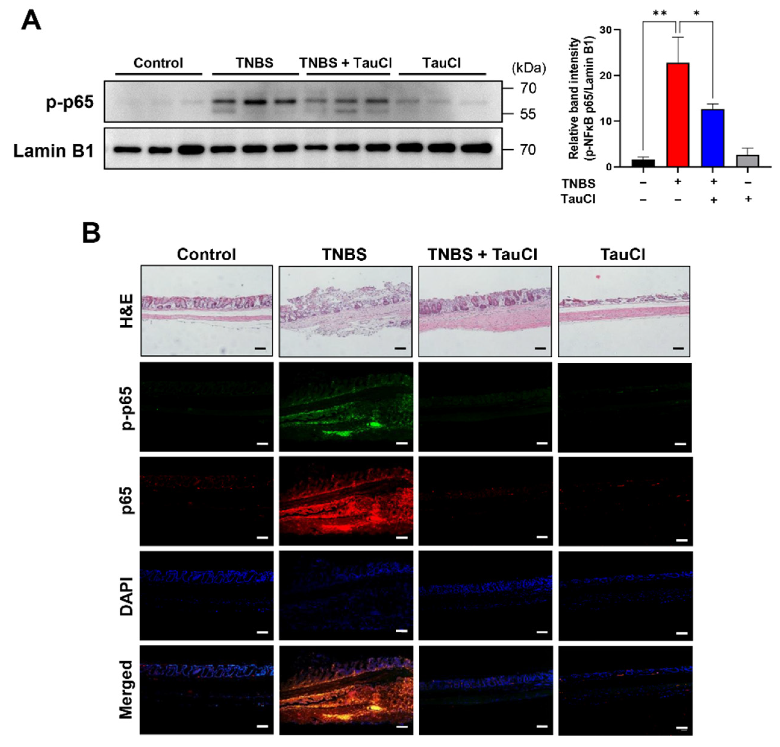 Antioxidants 10 00479 g004