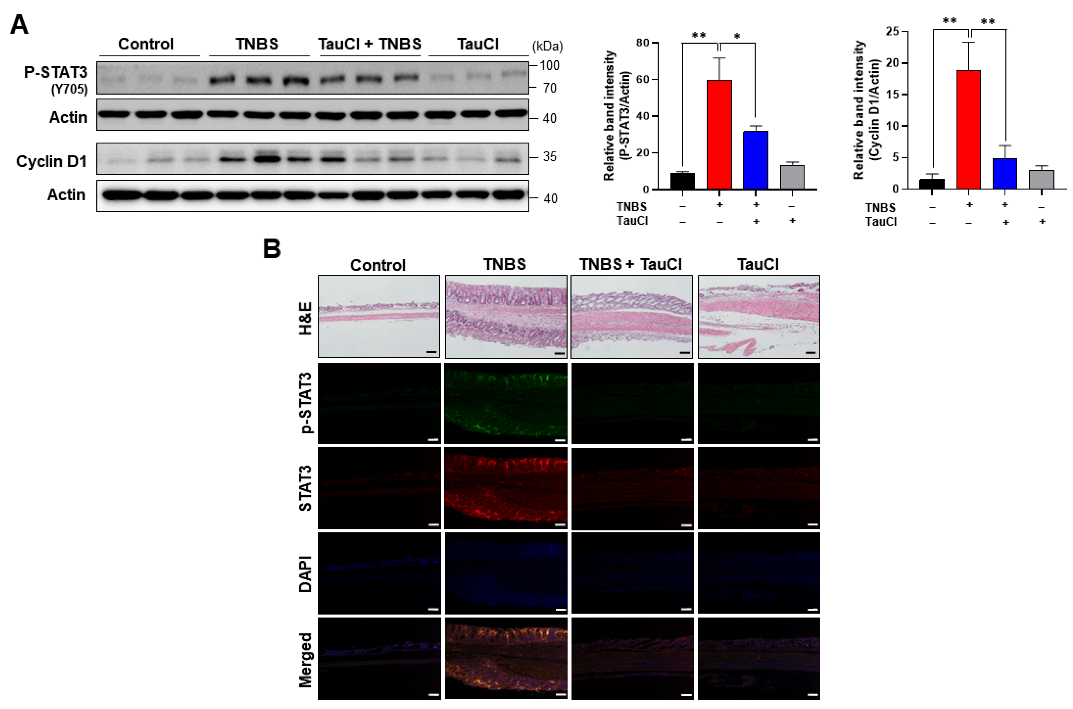 Antioxidants 10 00479 g005