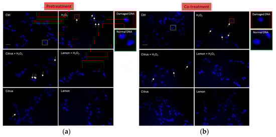 Antioxidants 10 00669 g0a1 Antioxidants 10 00669 g0a1