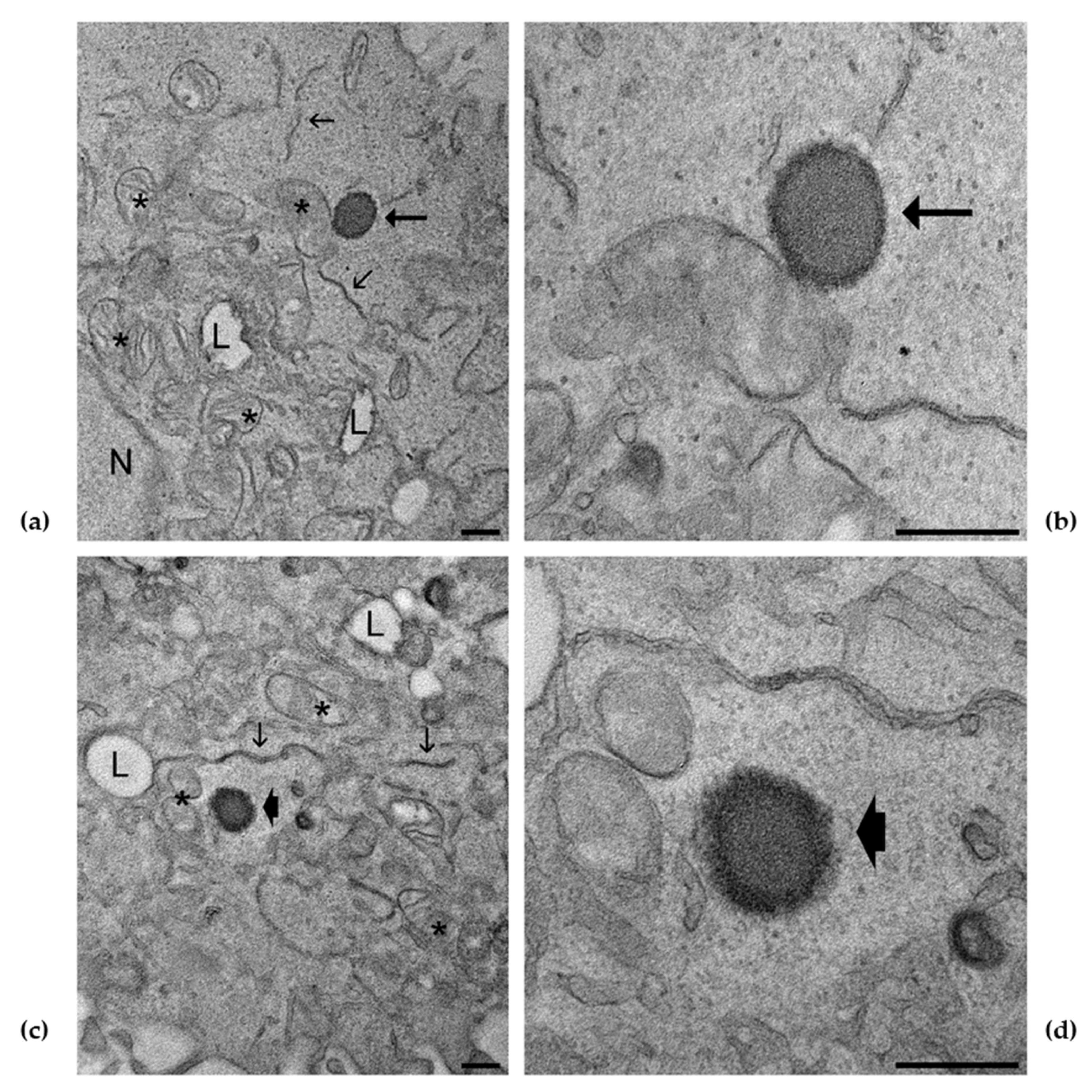 Antioxidants 10 00768 g008