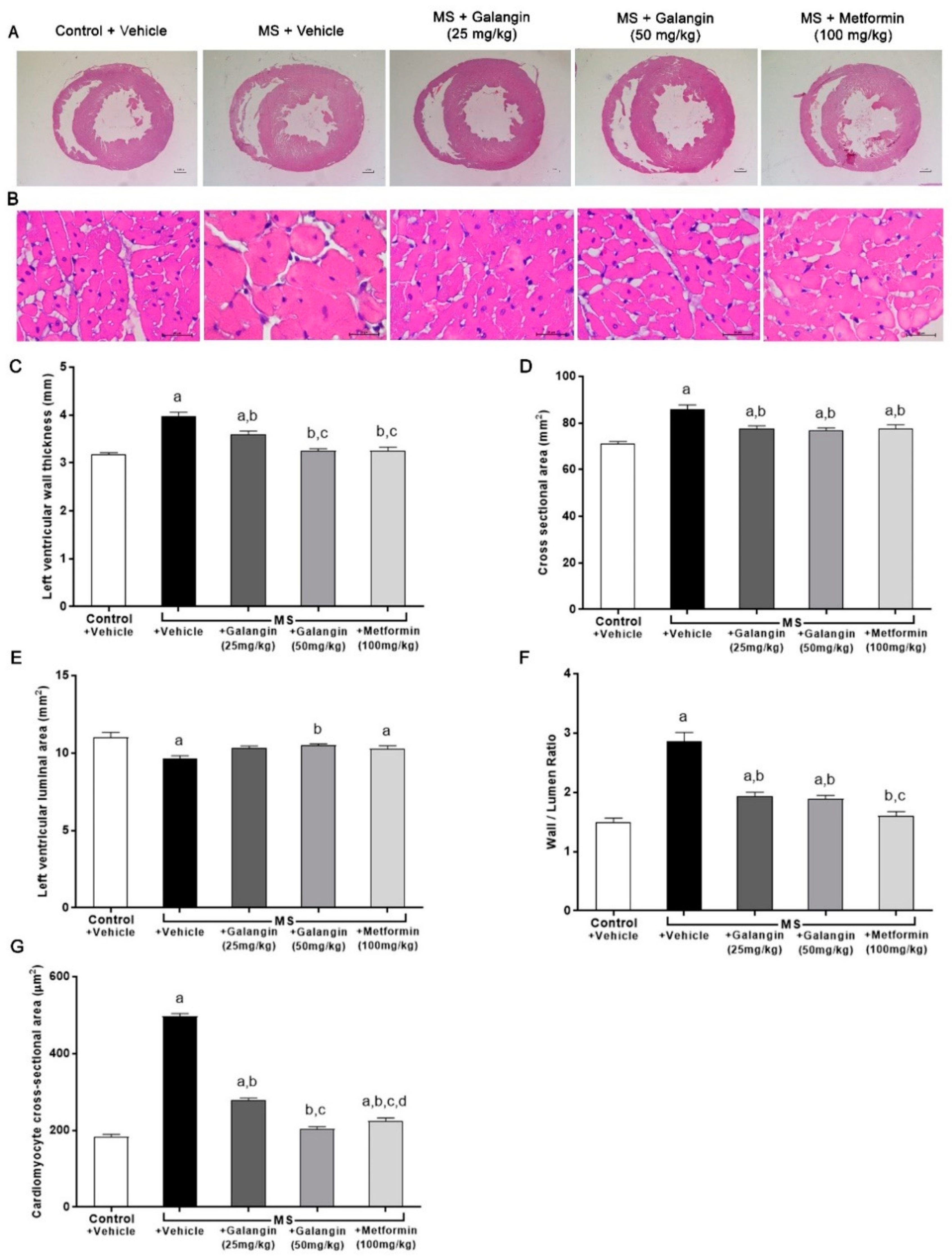 Antioxidants 10 00769 g004