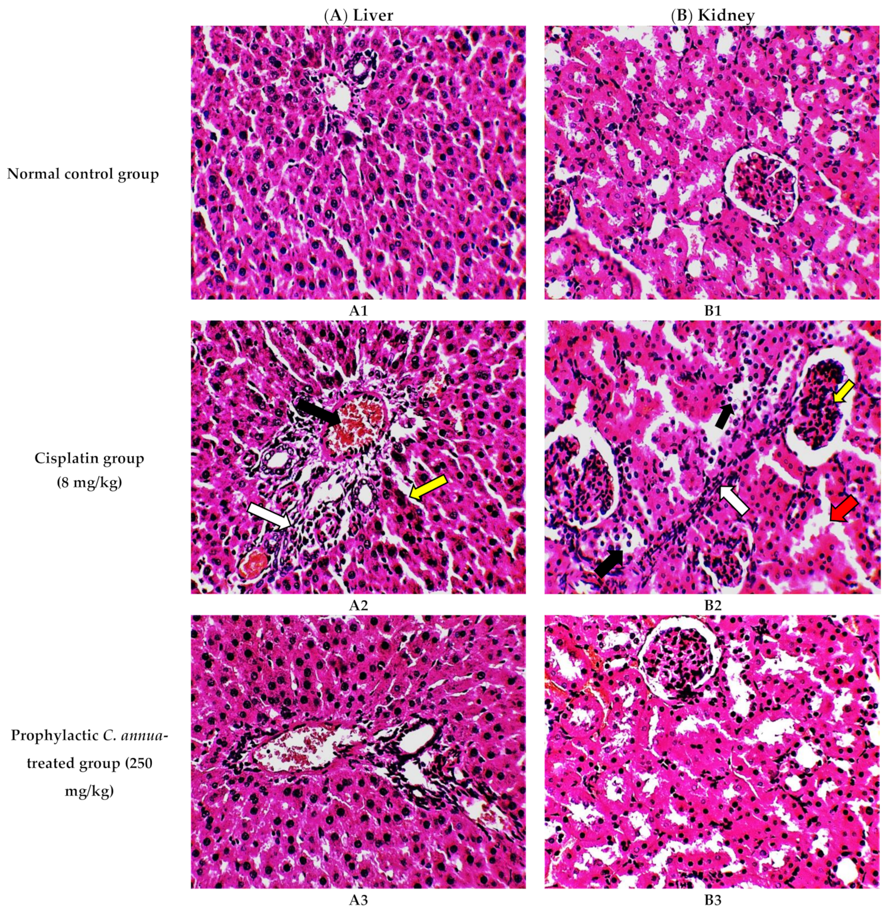 Antioxidants 10 00825 g001