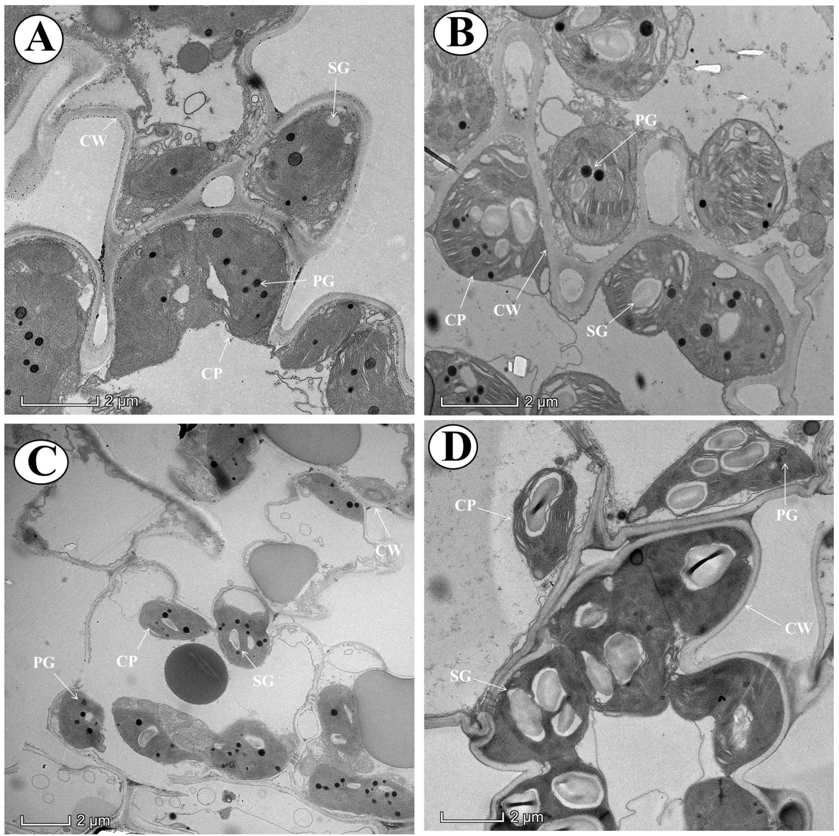 Antioxidants 10 00838 g002 Antioxidants 10 00838 g002