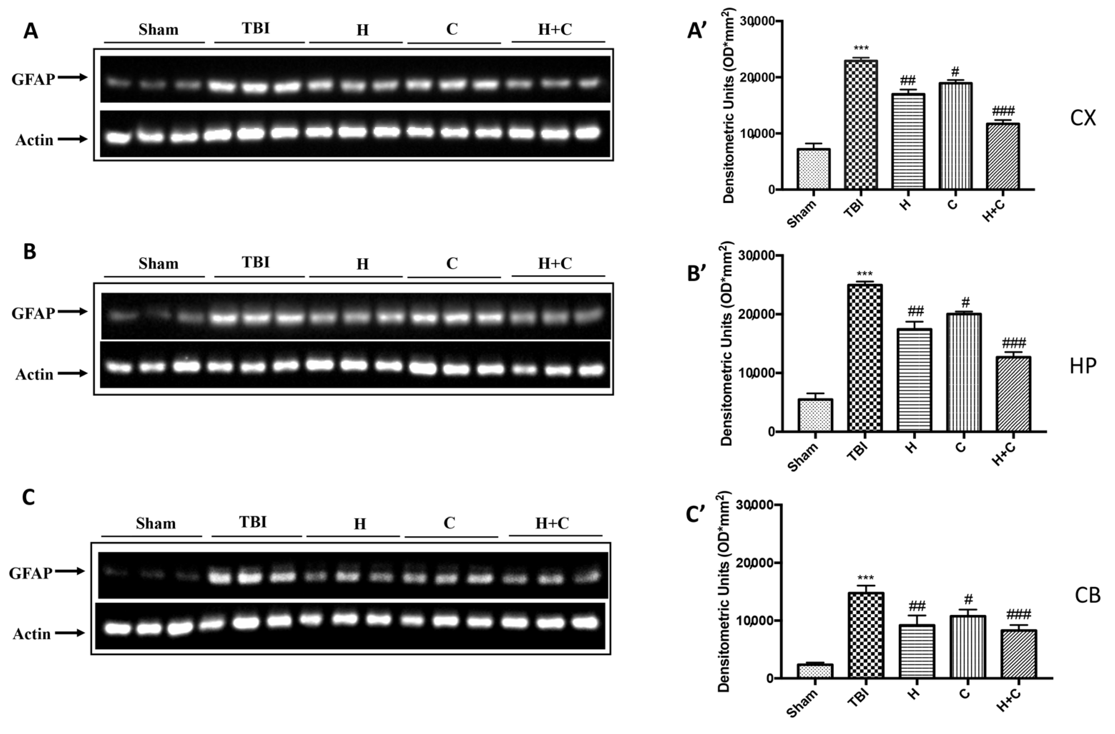 Antioxidants 10 00898 g004