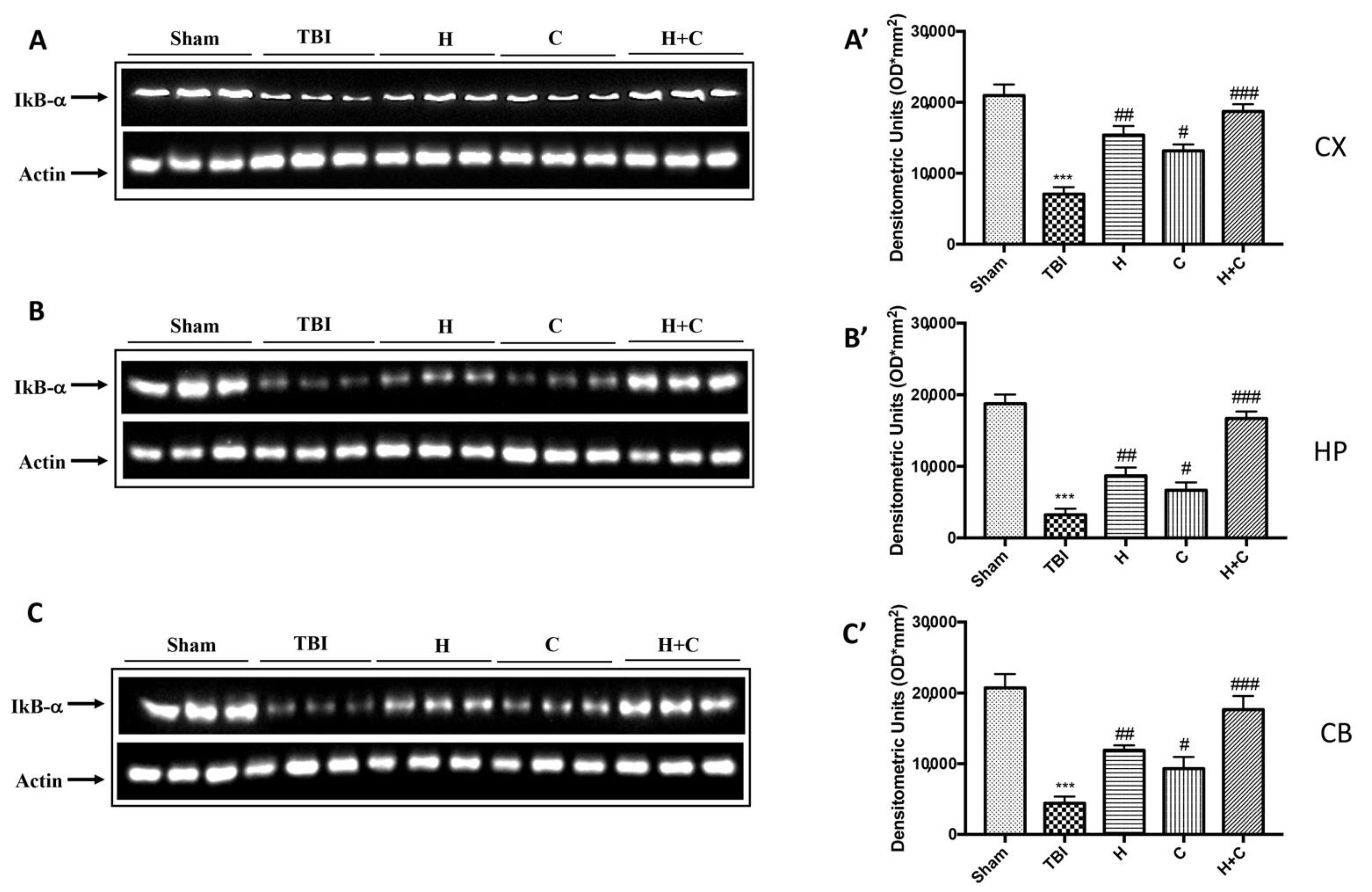 Antioxidants 10 00898 g006