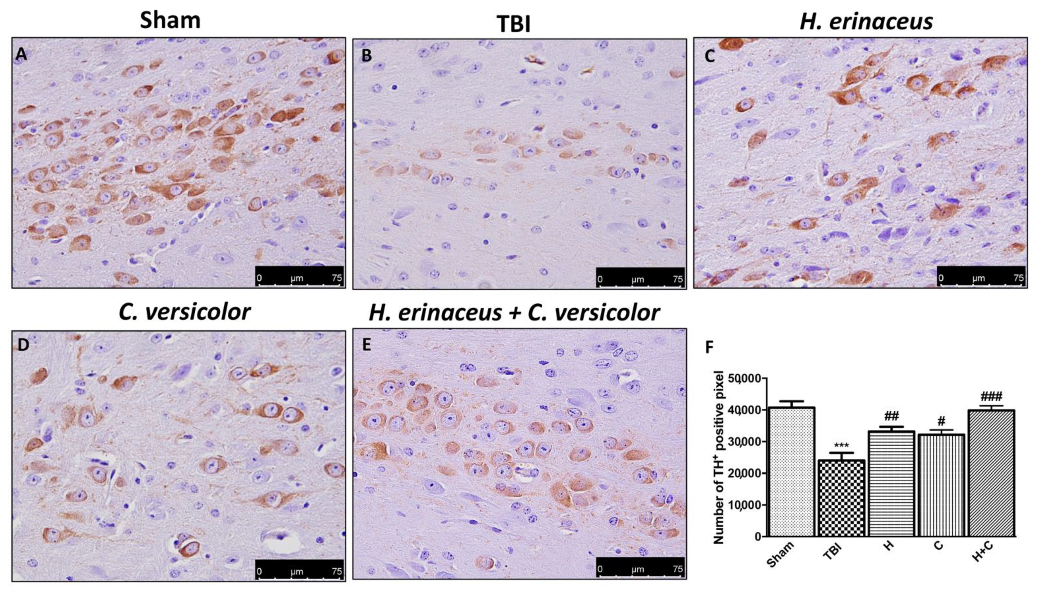 Antioxidants 10 00898 g012