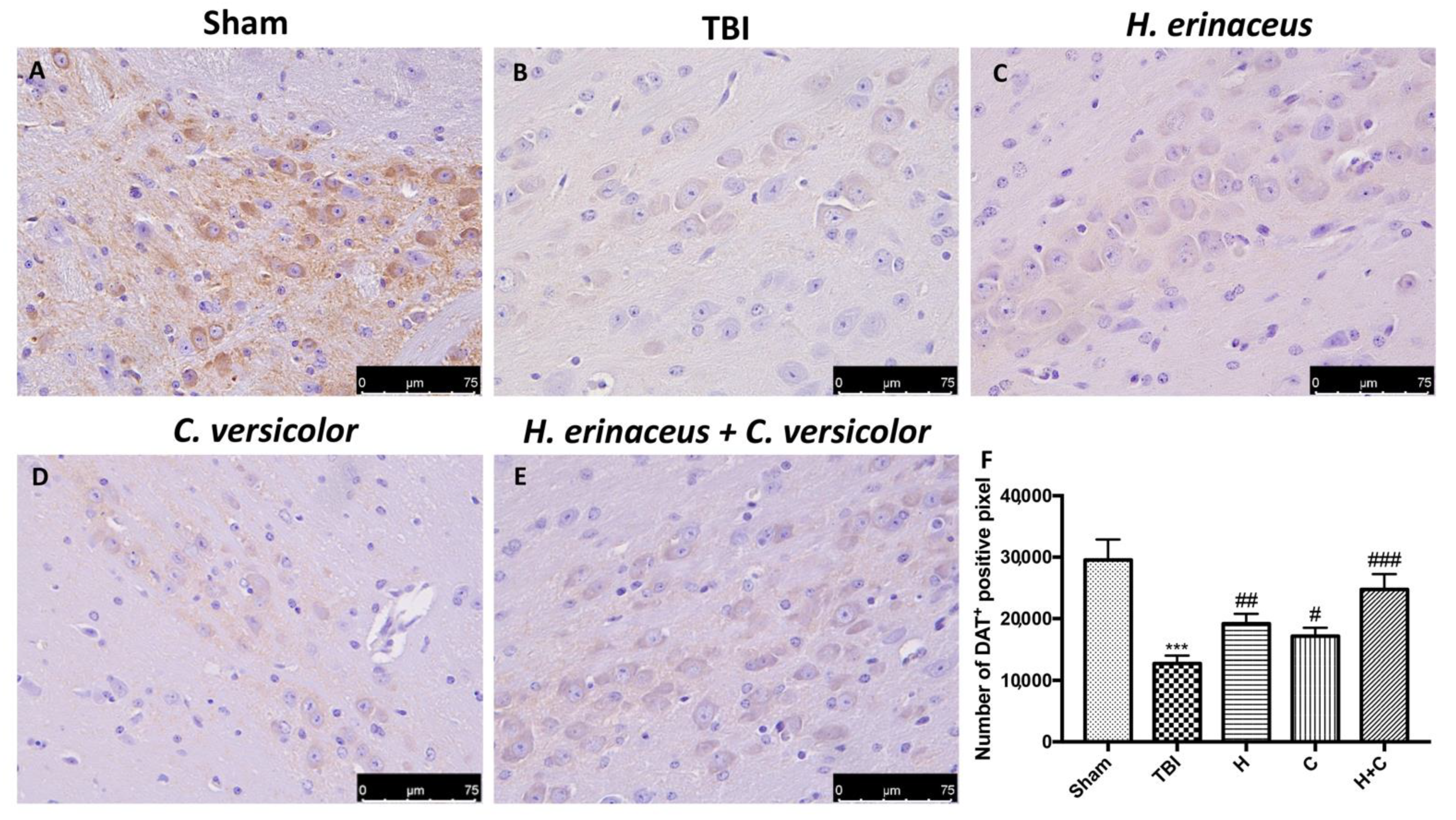Antioxidants 10 00898 g013