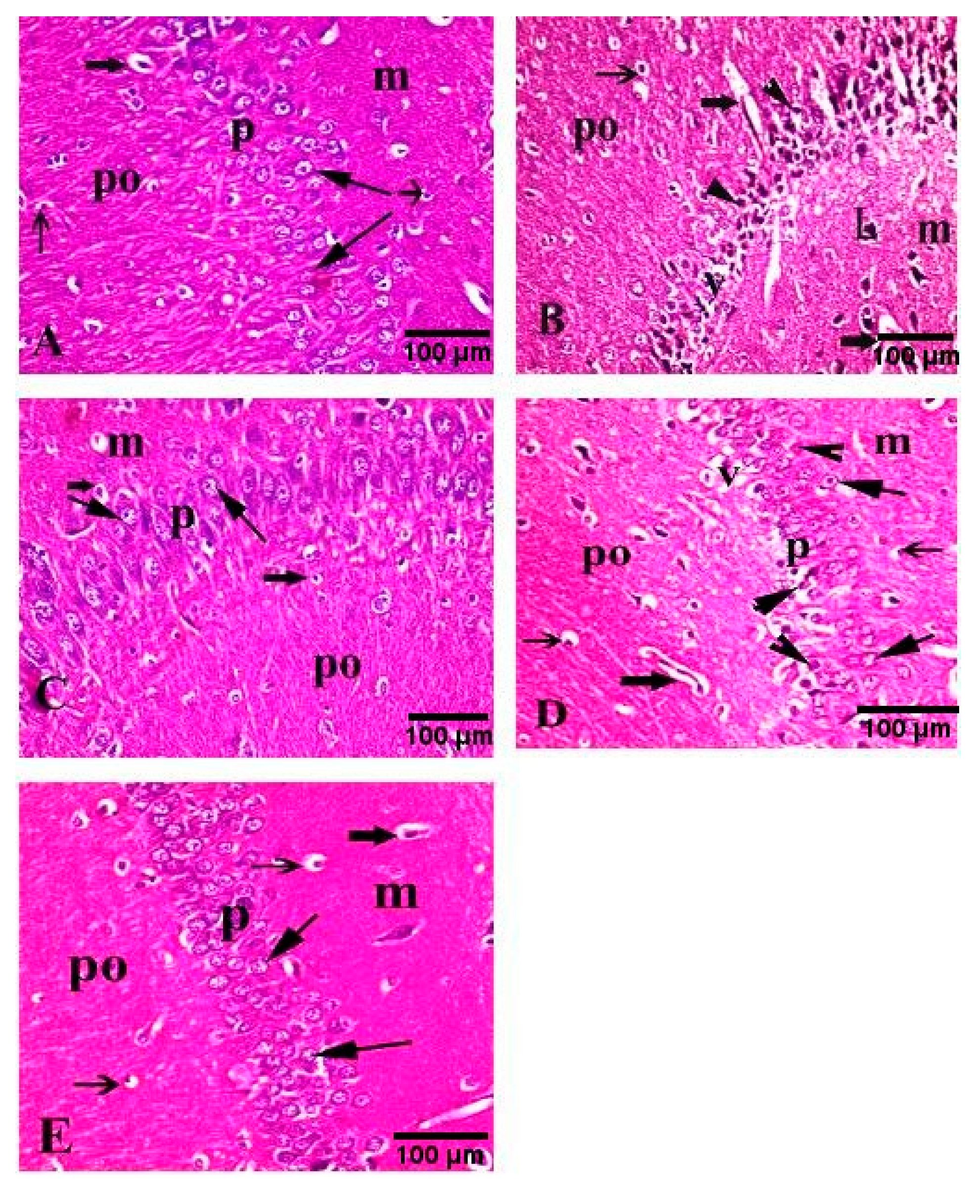 Antioxidants 10 00947 g006