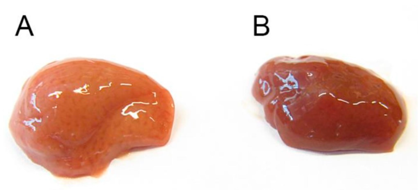 Antioxidants 10 01070 g014