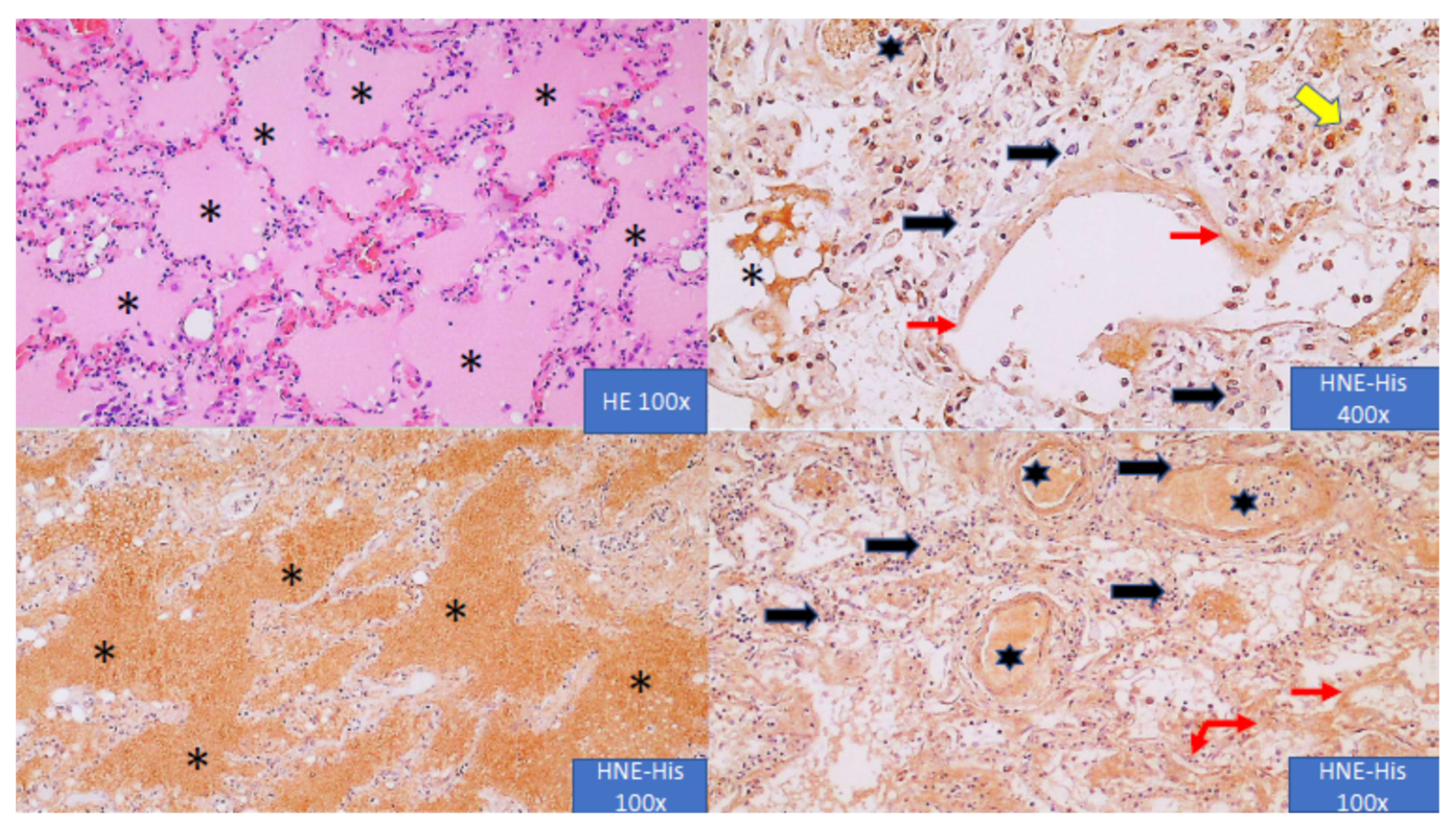 Antioxidants 10 01341 g002