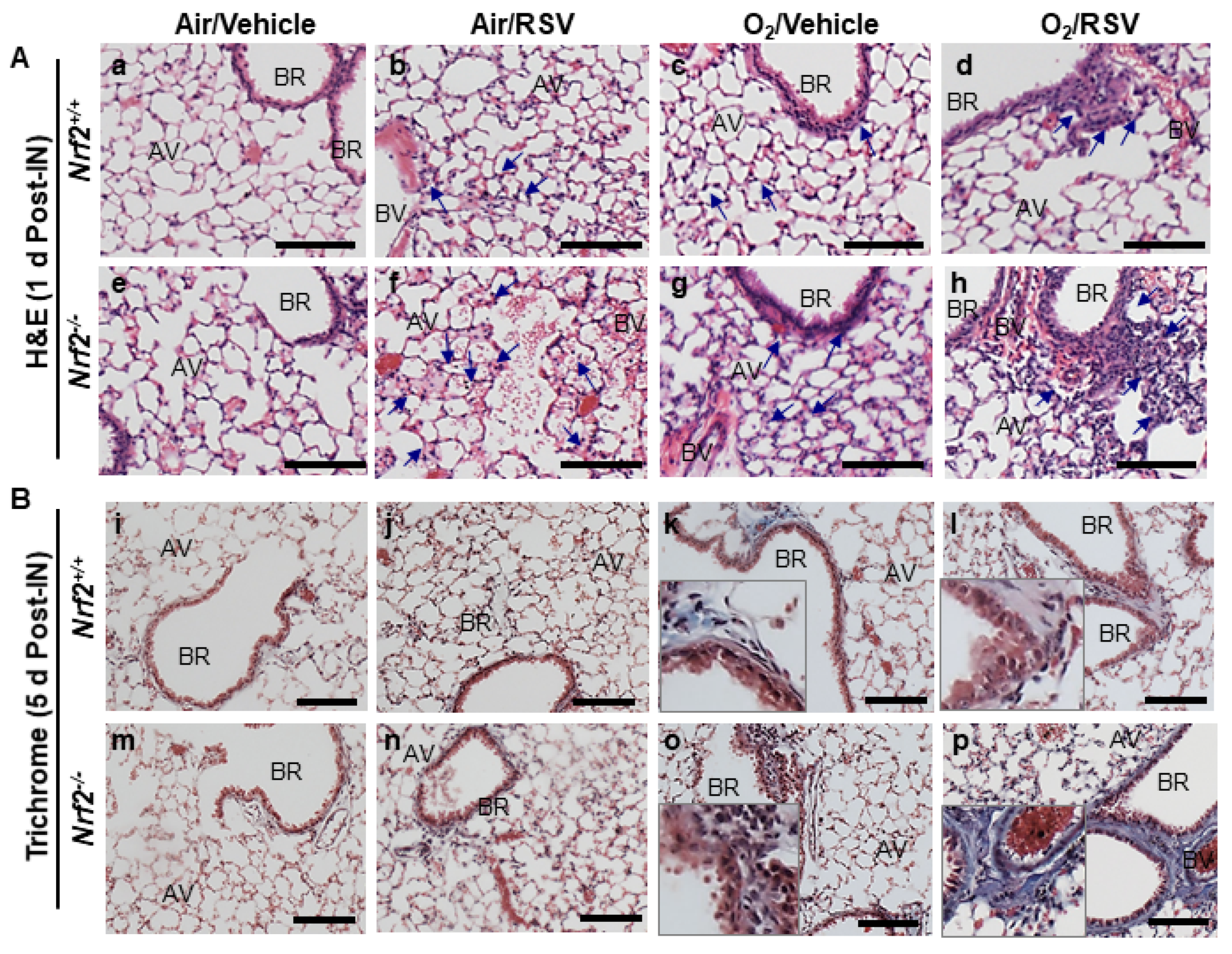 Antioxidants 10 01874 g002