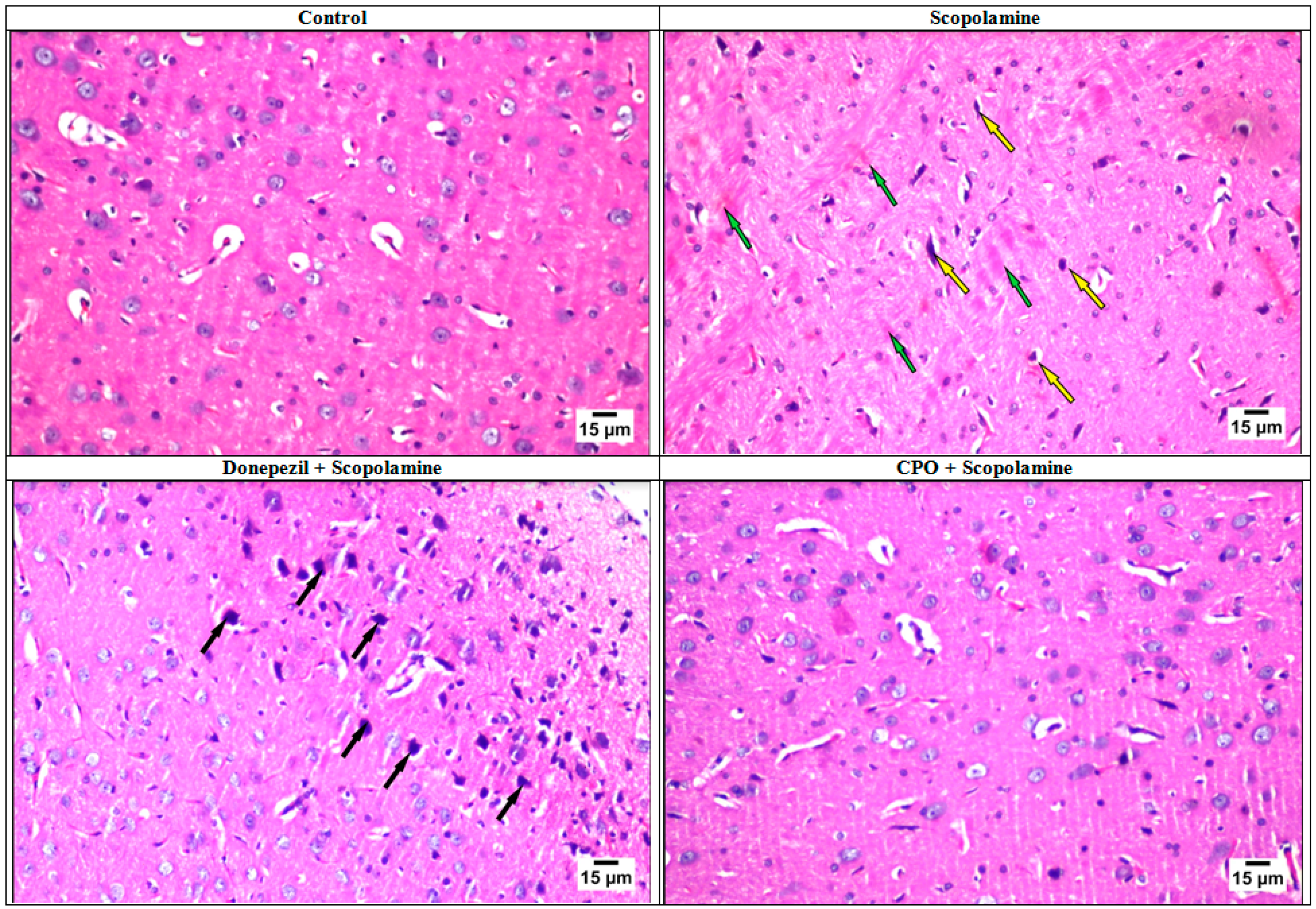 Antioxidants 10 01993 g004