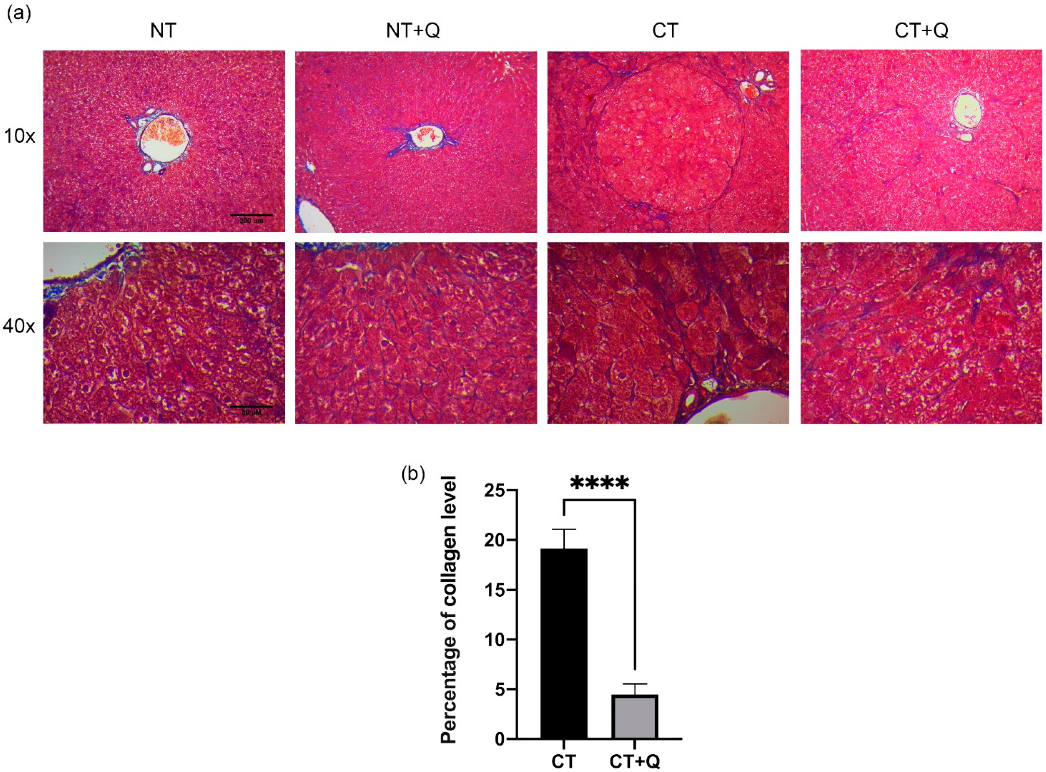 Antioxidants 11 00358 g004