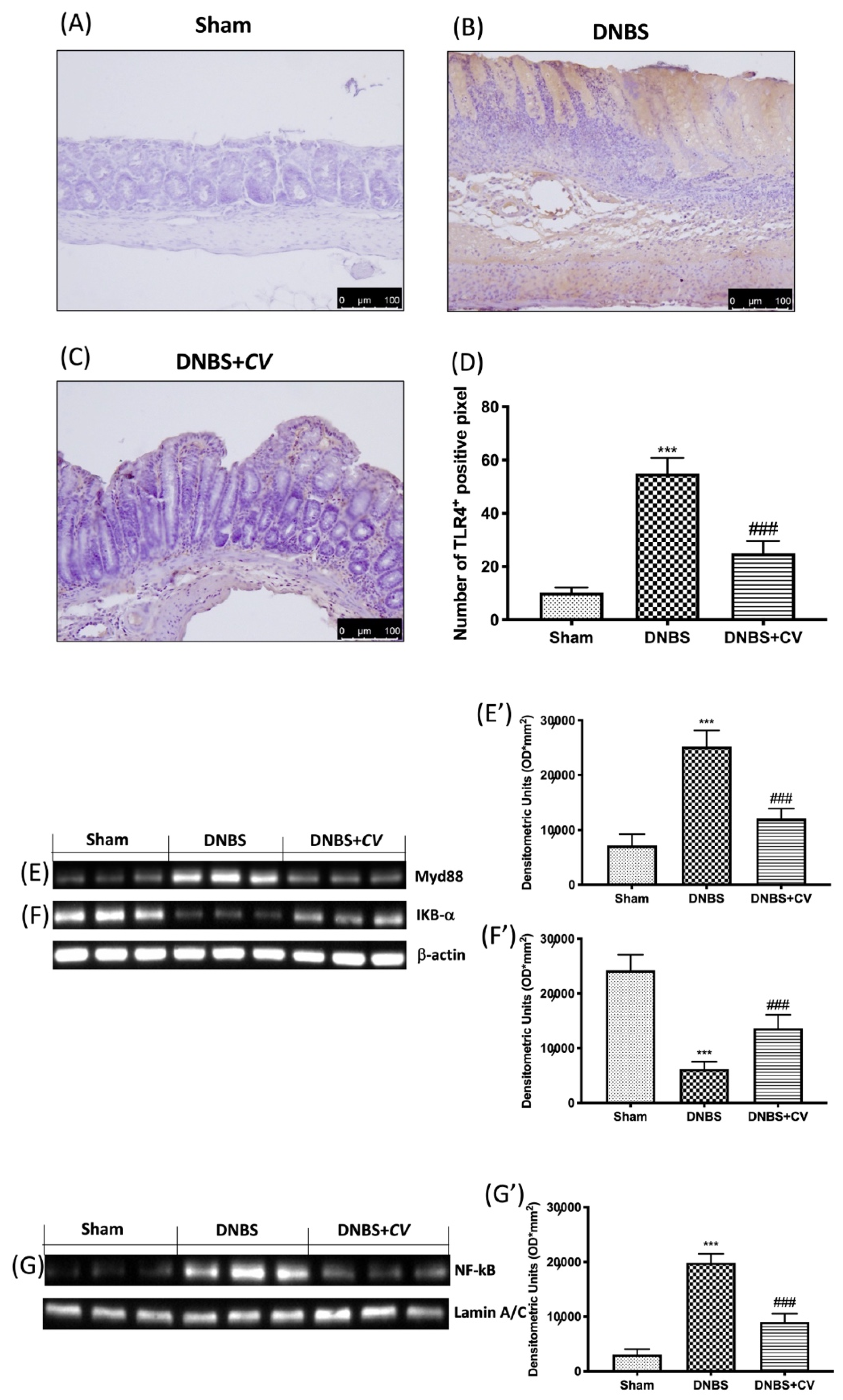 Antioxidants 11 00406 g003