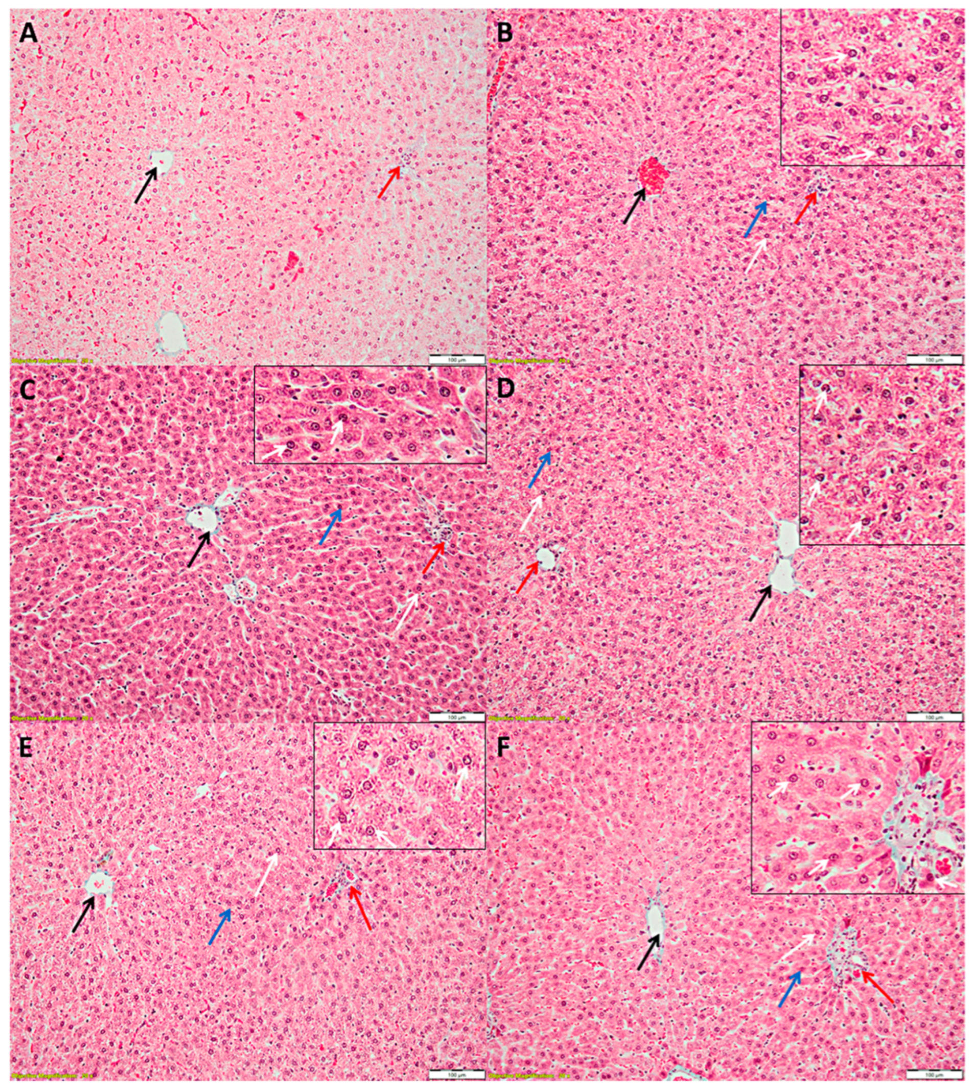 Antioxidants 11 00412 g004
