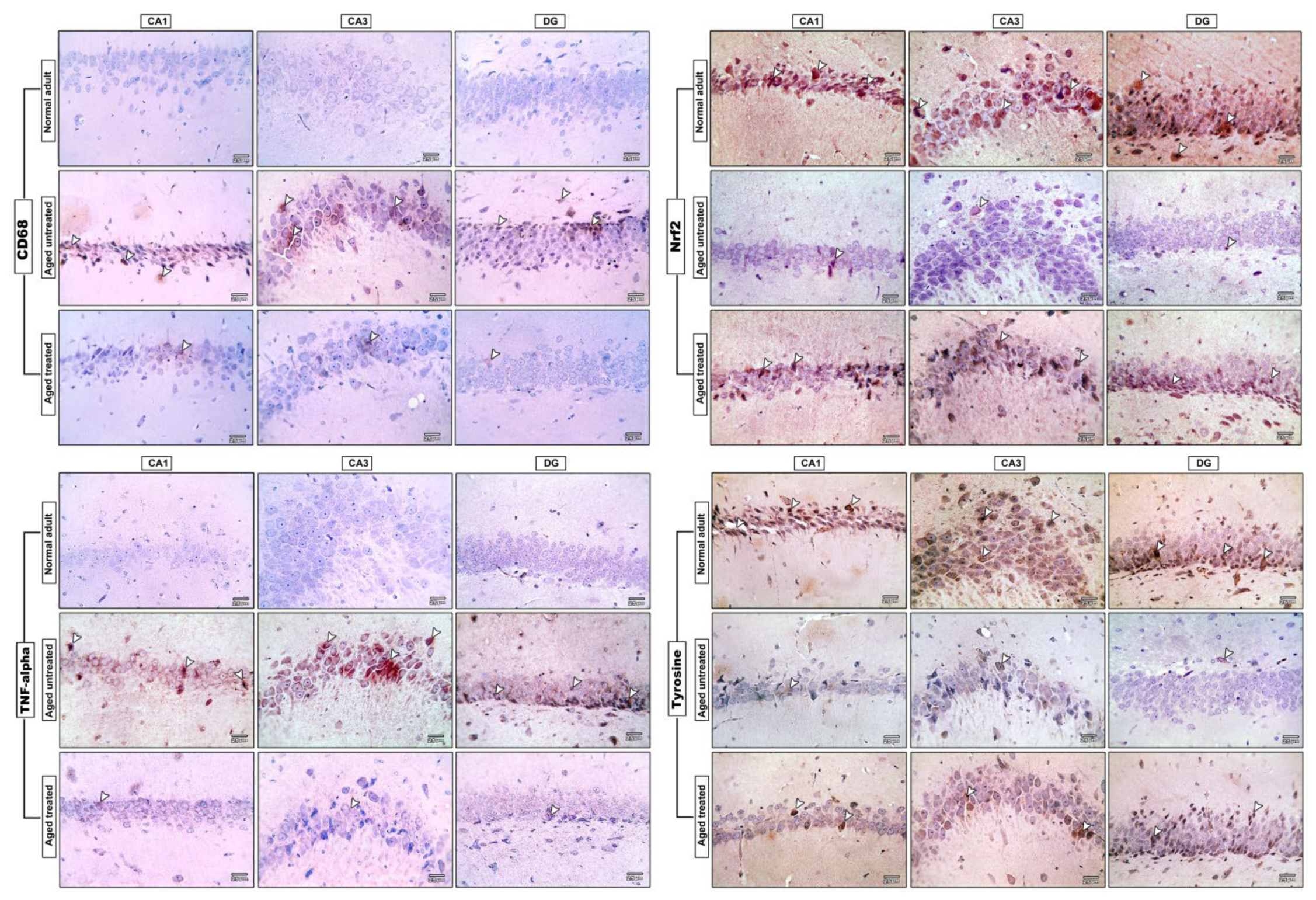 Antioxidants 11 00514 g008