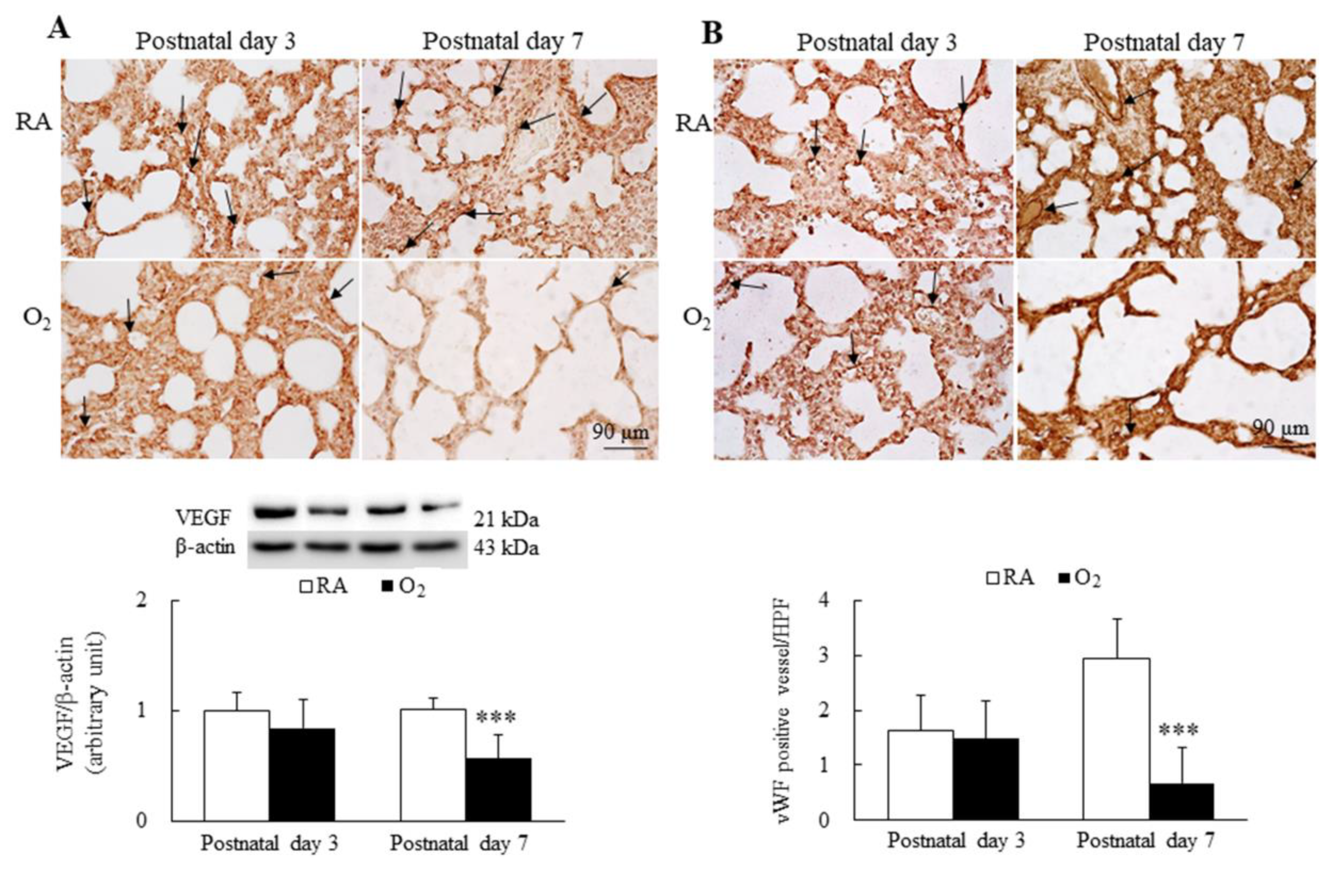 Antioxidants 11 00641 g005